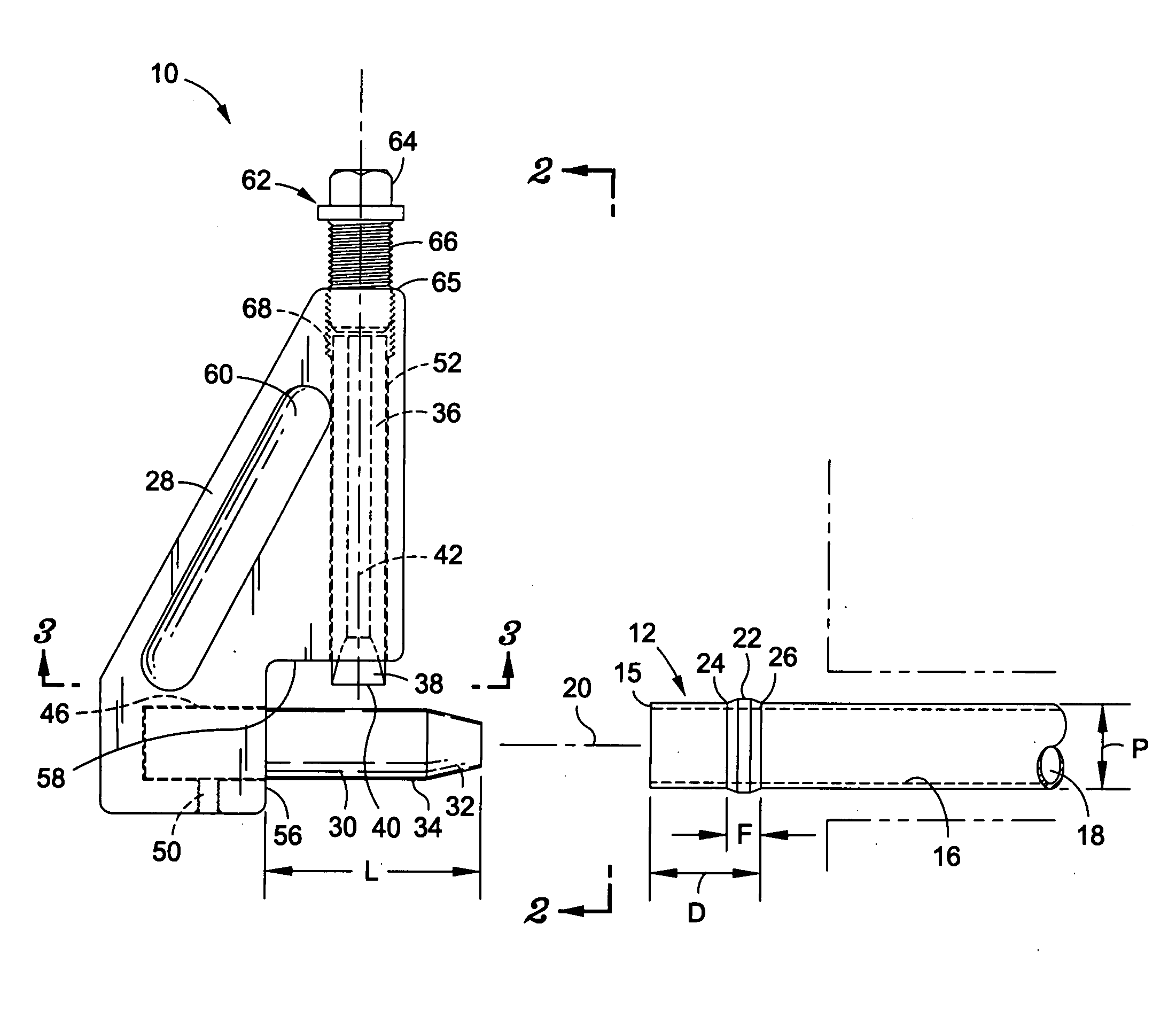 Compression sleeve splitter and removal tool