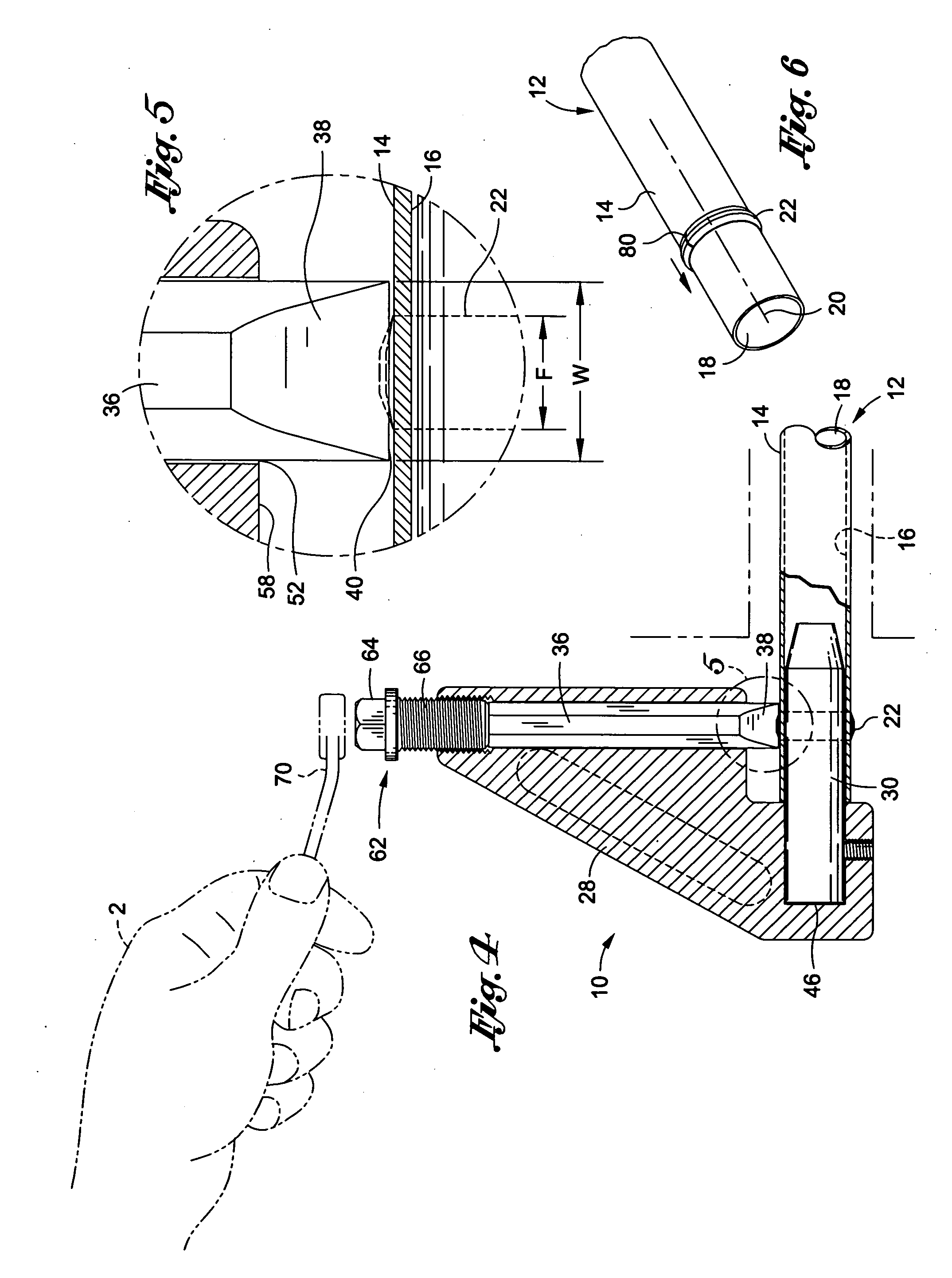 Compression sleeve splitter and removal tool