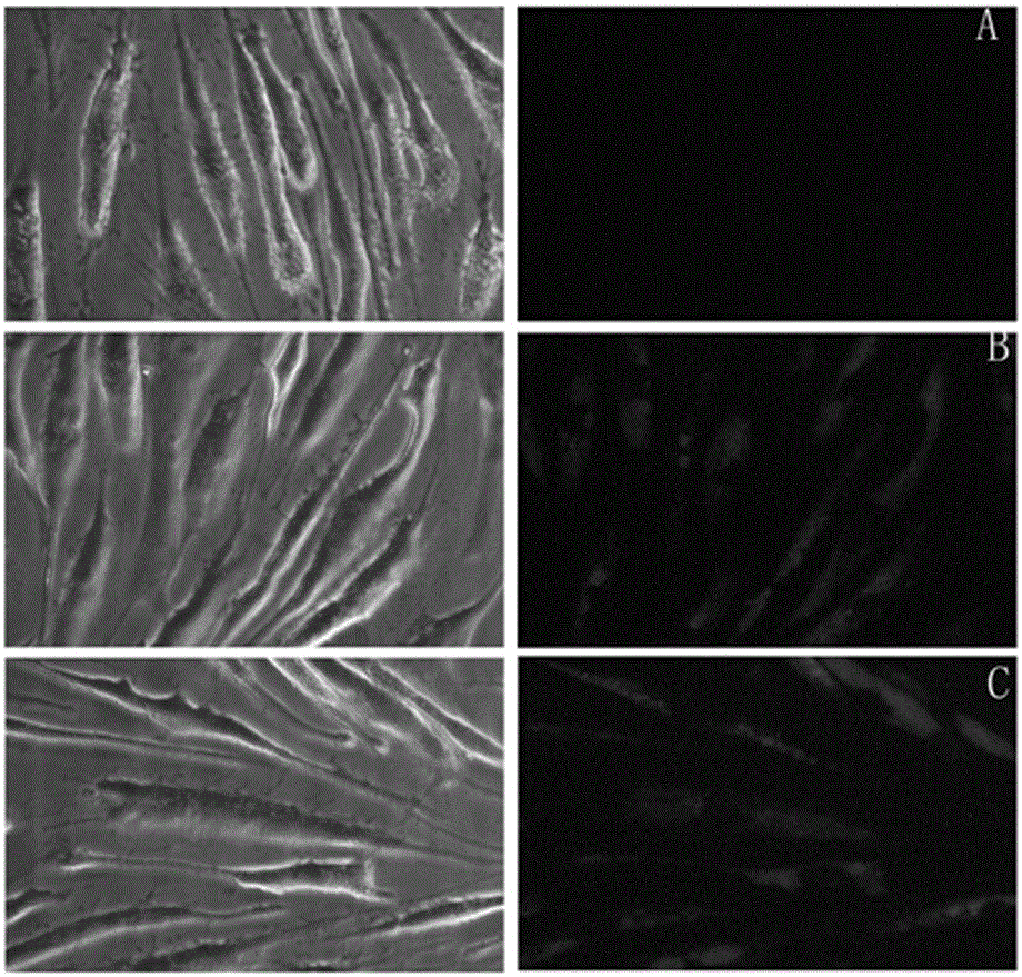 Coating intravascular stent with chitosan carrying siRNA and preparation method of coating intravascular stent