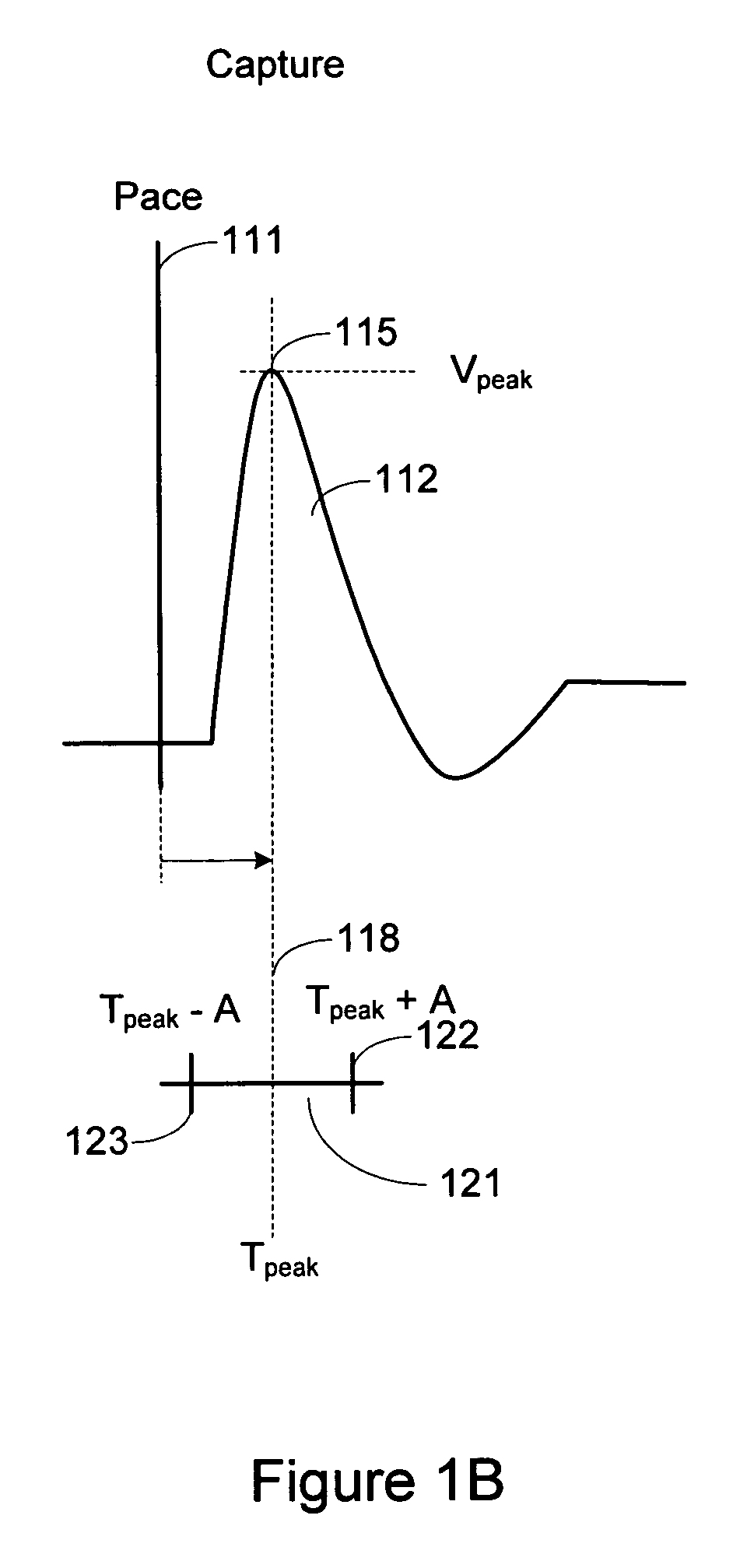 Cardiac pacing response classification based on waveform feature variability