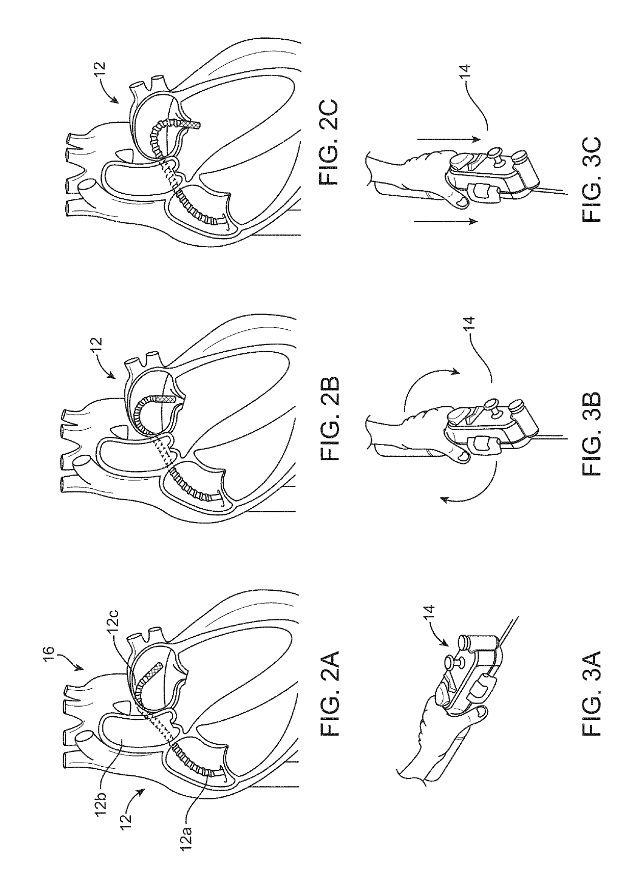 Matrix supported balloon articulation systems, devices, and methods for catheters and other uses