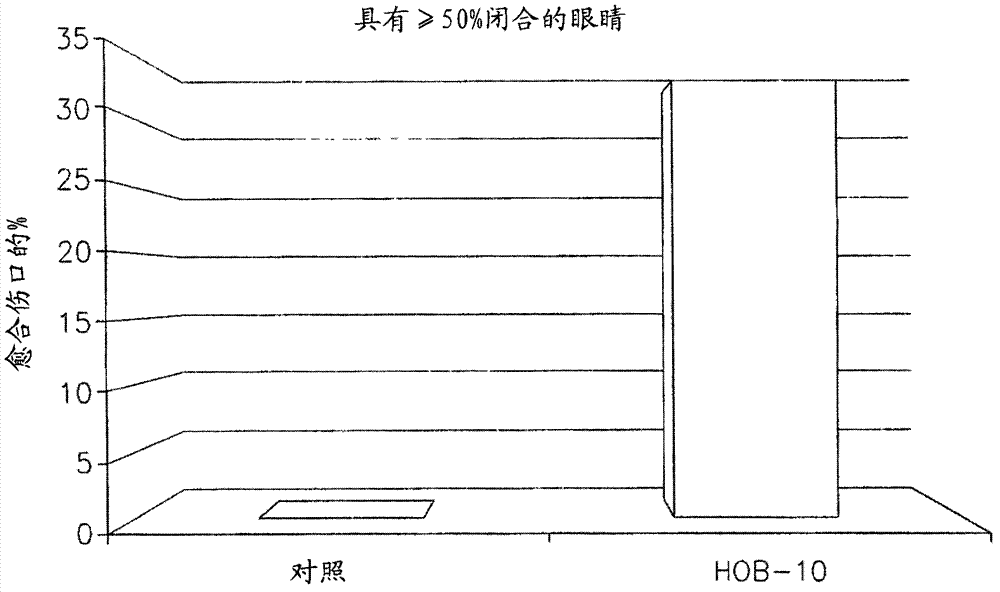 Buffered ophthalmic compositions and methods of use thereof