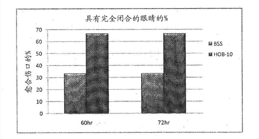 Buffered ophthalmic compositions and methods of use thereof