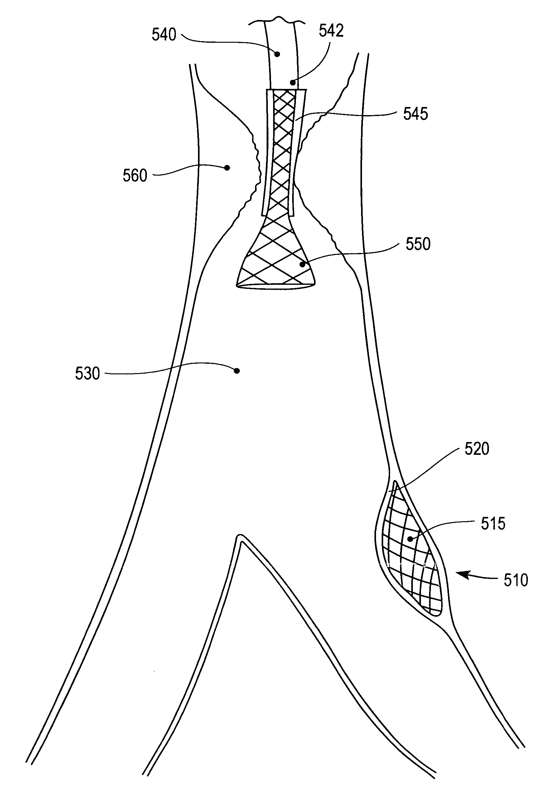 Method and apparatus for treating vulnerable plaque