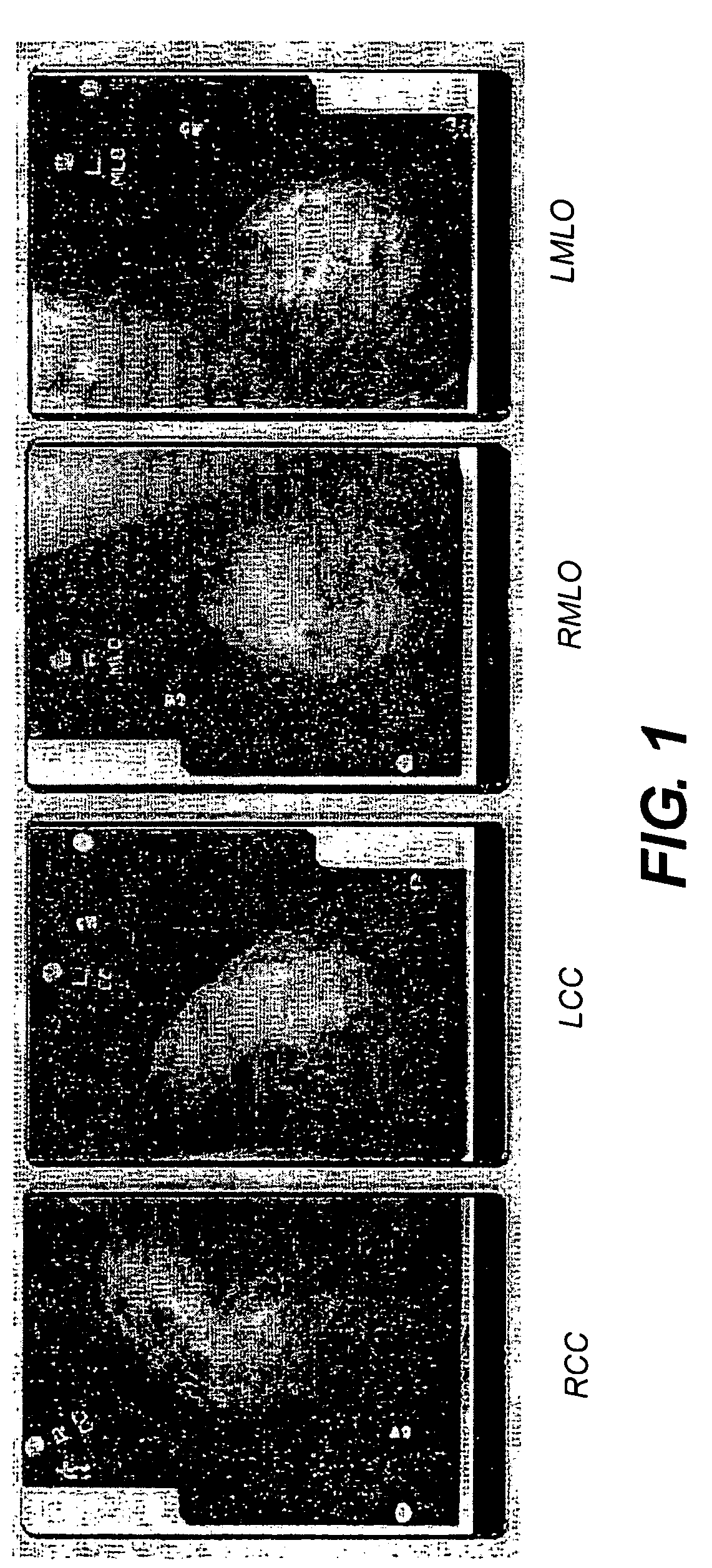 System and method for assigning mammographic view and laterality to individual images in groups of digitized mammograms