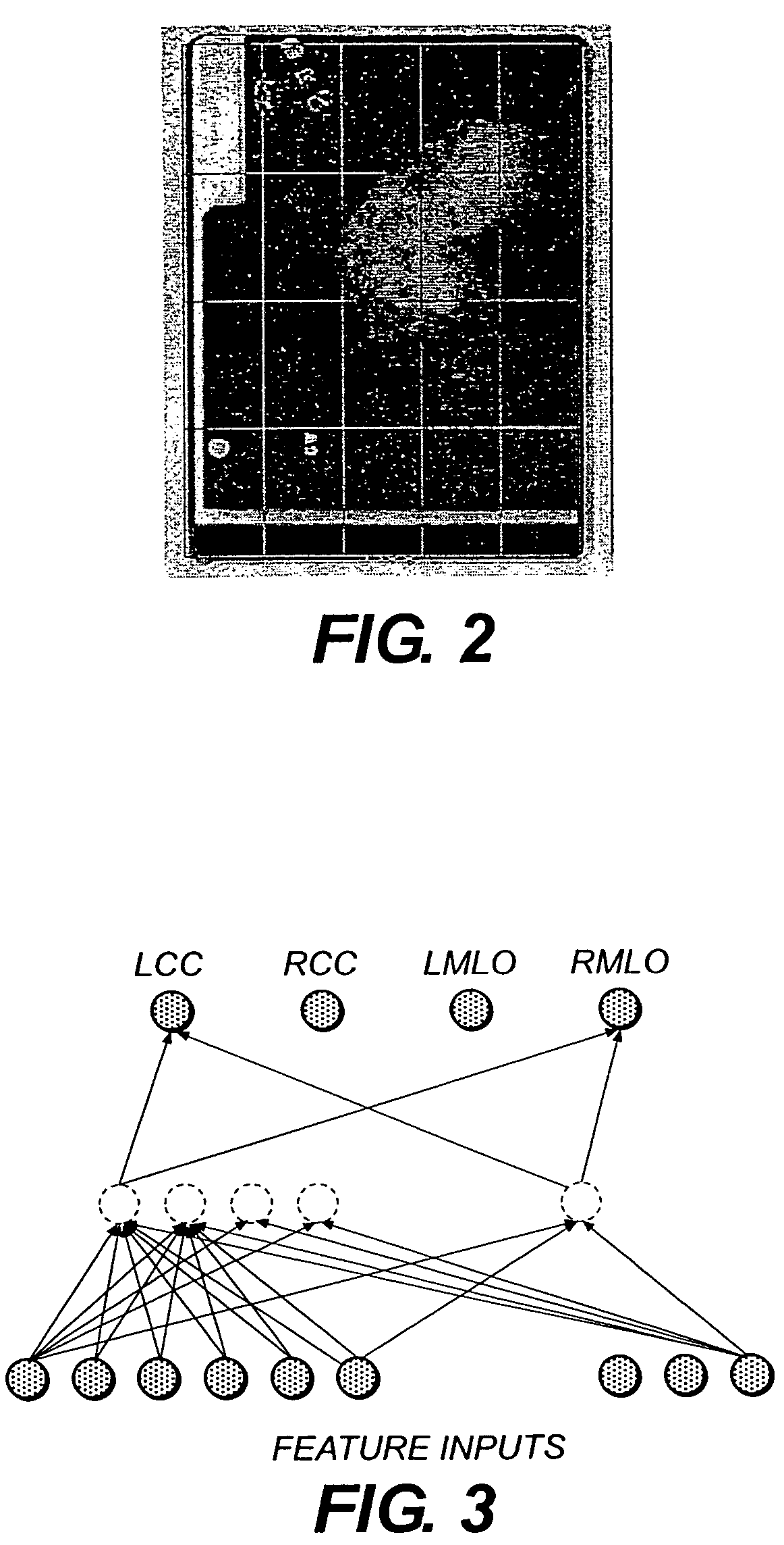 System and method for assigning mammographic view and laterality to individual images in groups of digitized mammograms
