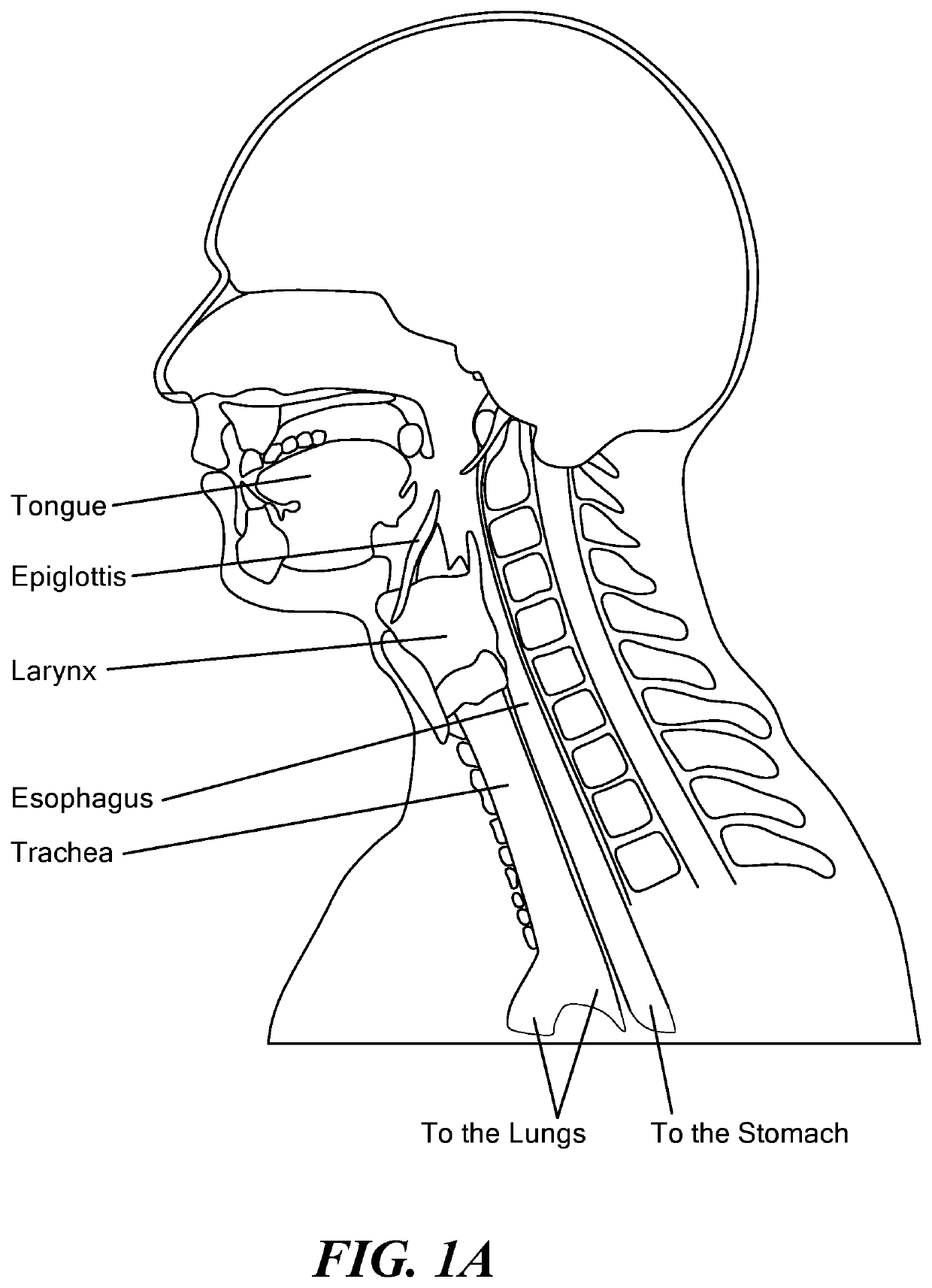 Eliciting Swallowing using Electrical Stimulation Applied via Surface Electrodes