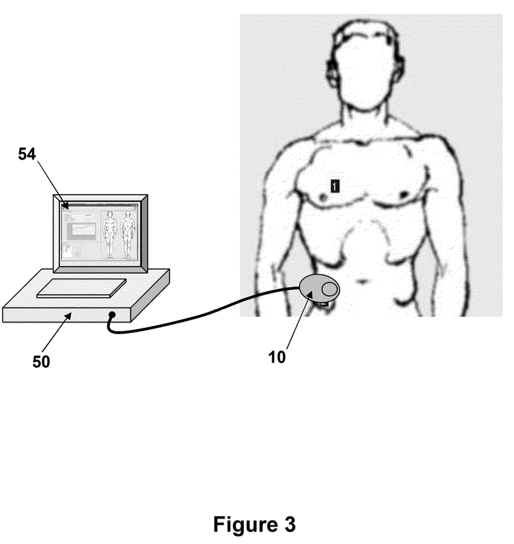 Tissue thickness and structure measurement device