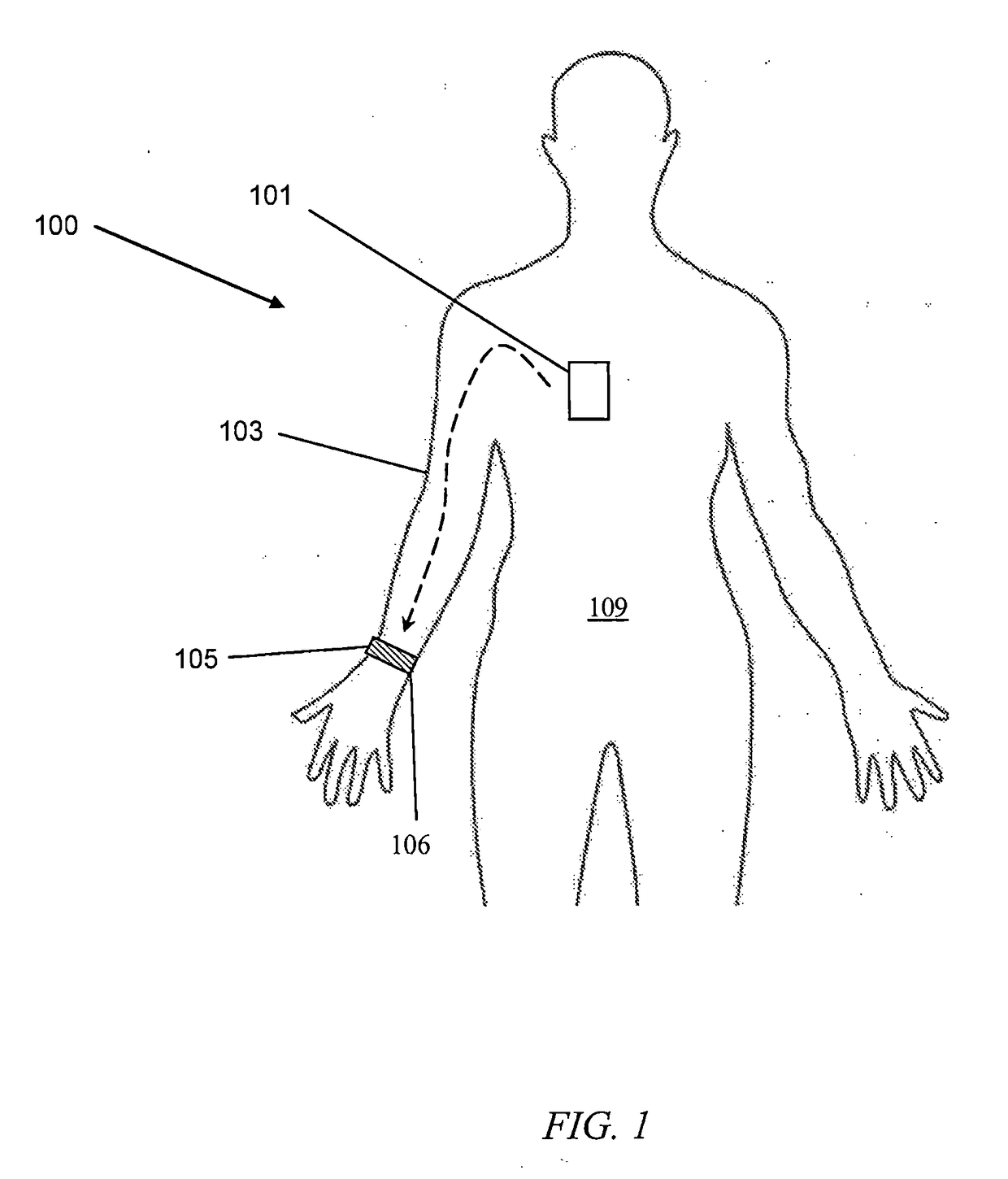 System and Method for Intra-Body Communication