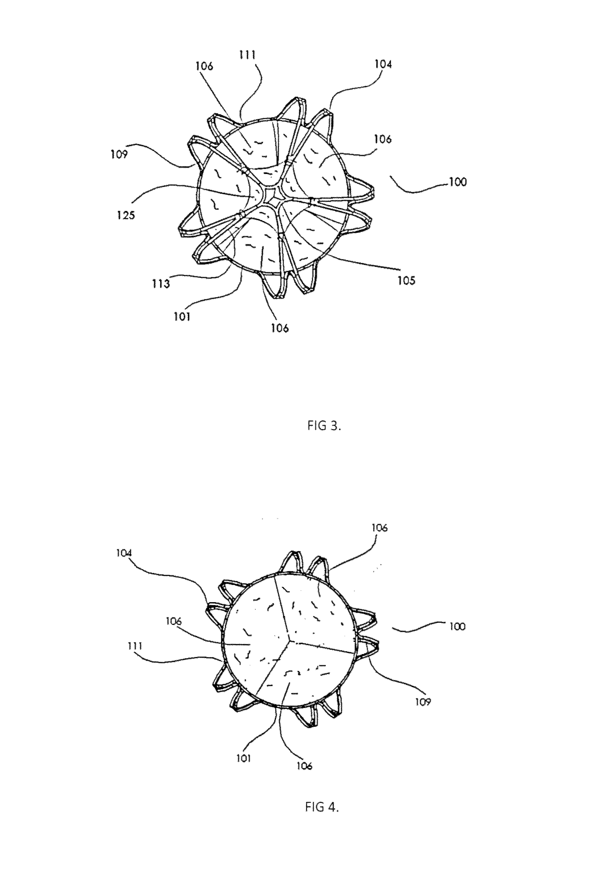 Transcatheter Pulmonary Ball Valve Assembly