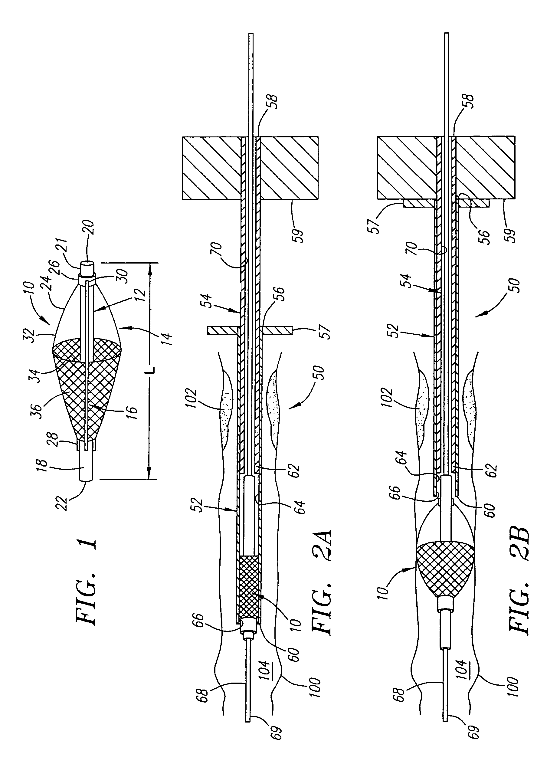 Deployable recoverable vascular filter and methods for use