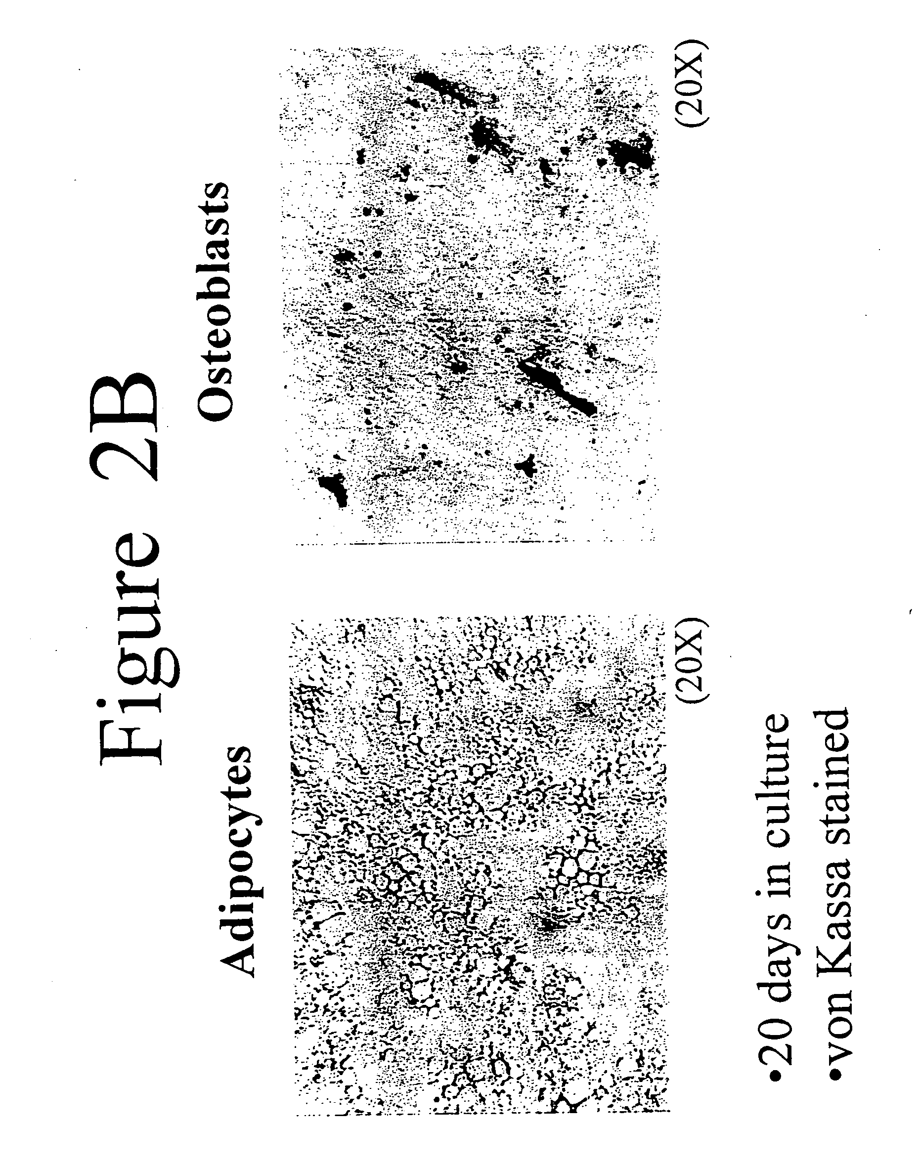 Differentiation of adipose stromal cells into osteoblasts and uses thereof