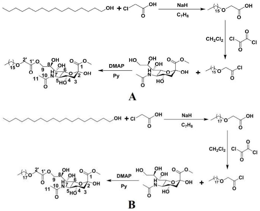 Sialic acid modified dexamethasone palmitate liposome as well as preparation and application thereof