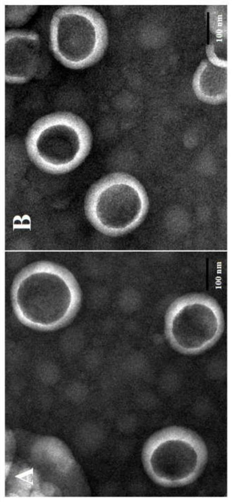 Sialic acid modified dexamethasone palmitate liposome as well as preparation and application thereof