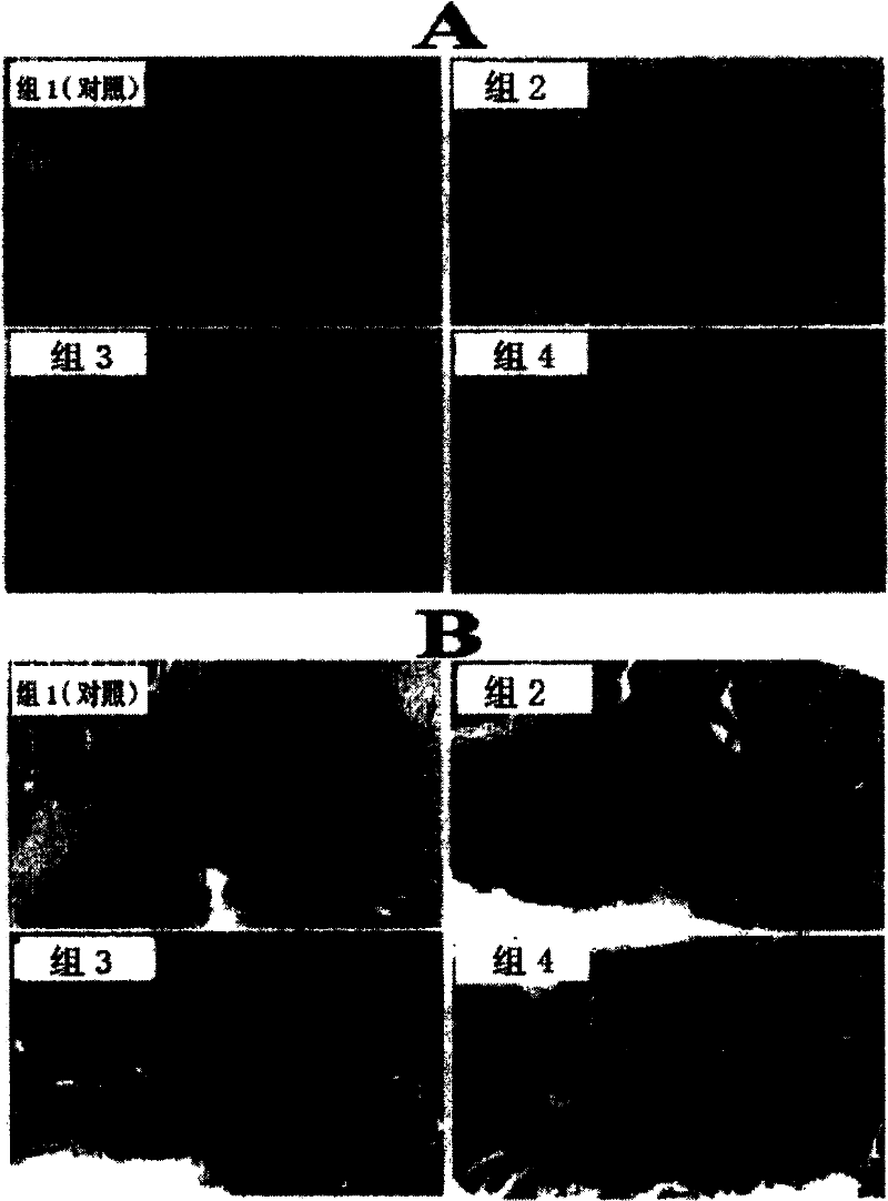 Application of Chinese traditional medicine compounds on preparing medicines promoting mesenchymal stem cells surviving in the body and cardioblast differentiation