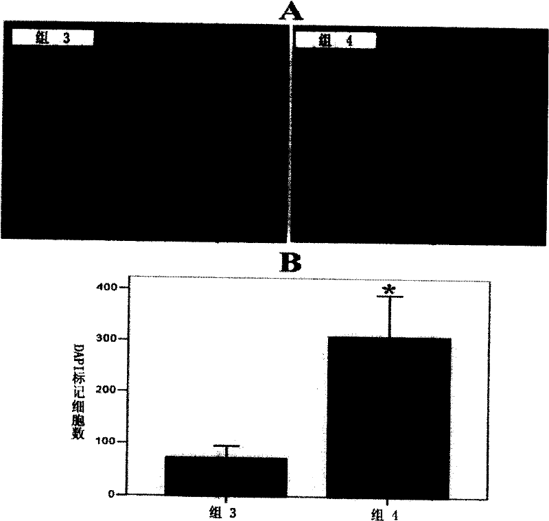 Application of Chinese traditional medicine compounds on preparing medicines promoting mesenchymal stem cells surviving in the body and cardioblast differentiation