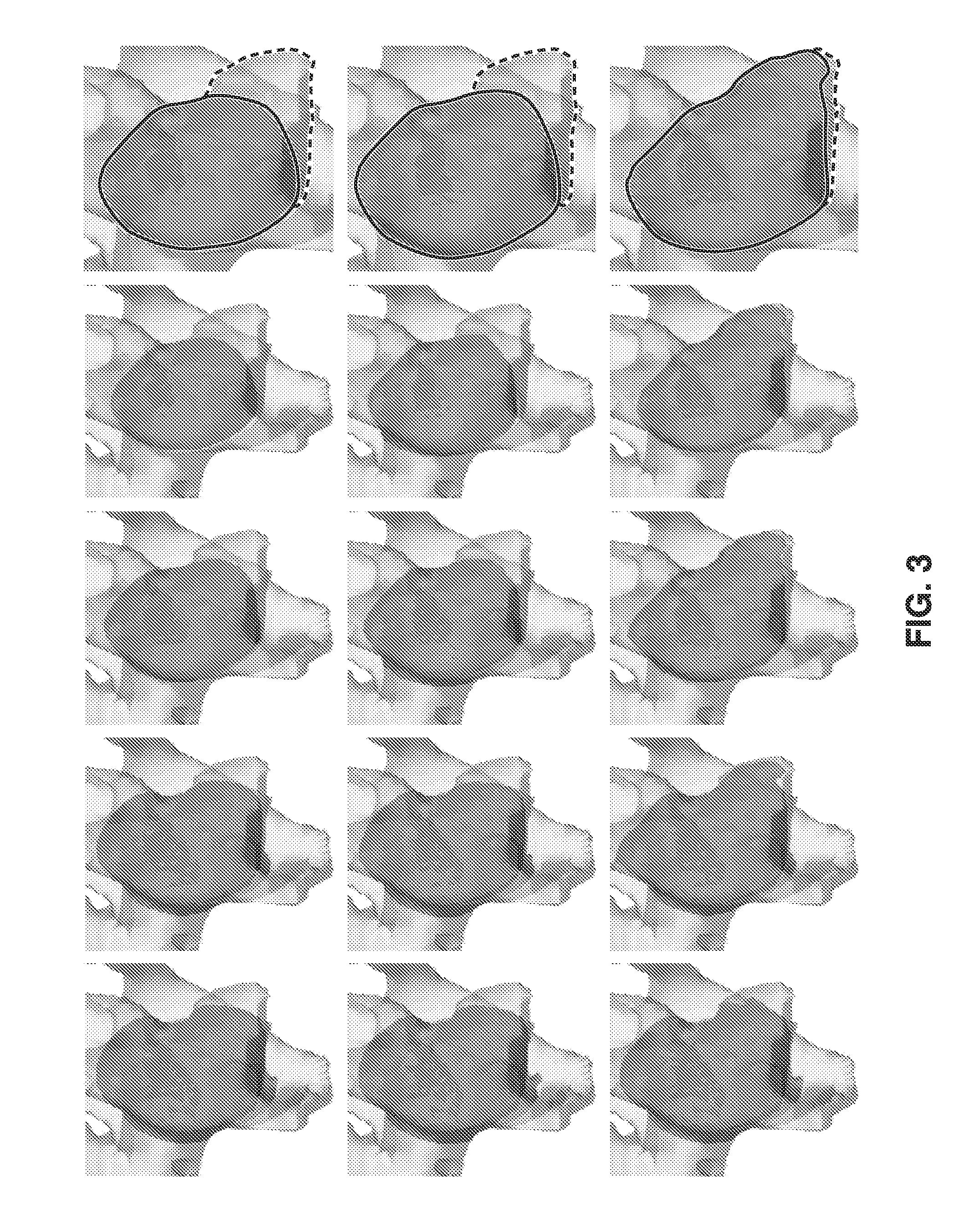 Apparatus and method for surface capturing and volumetric analysis of multidimensional images