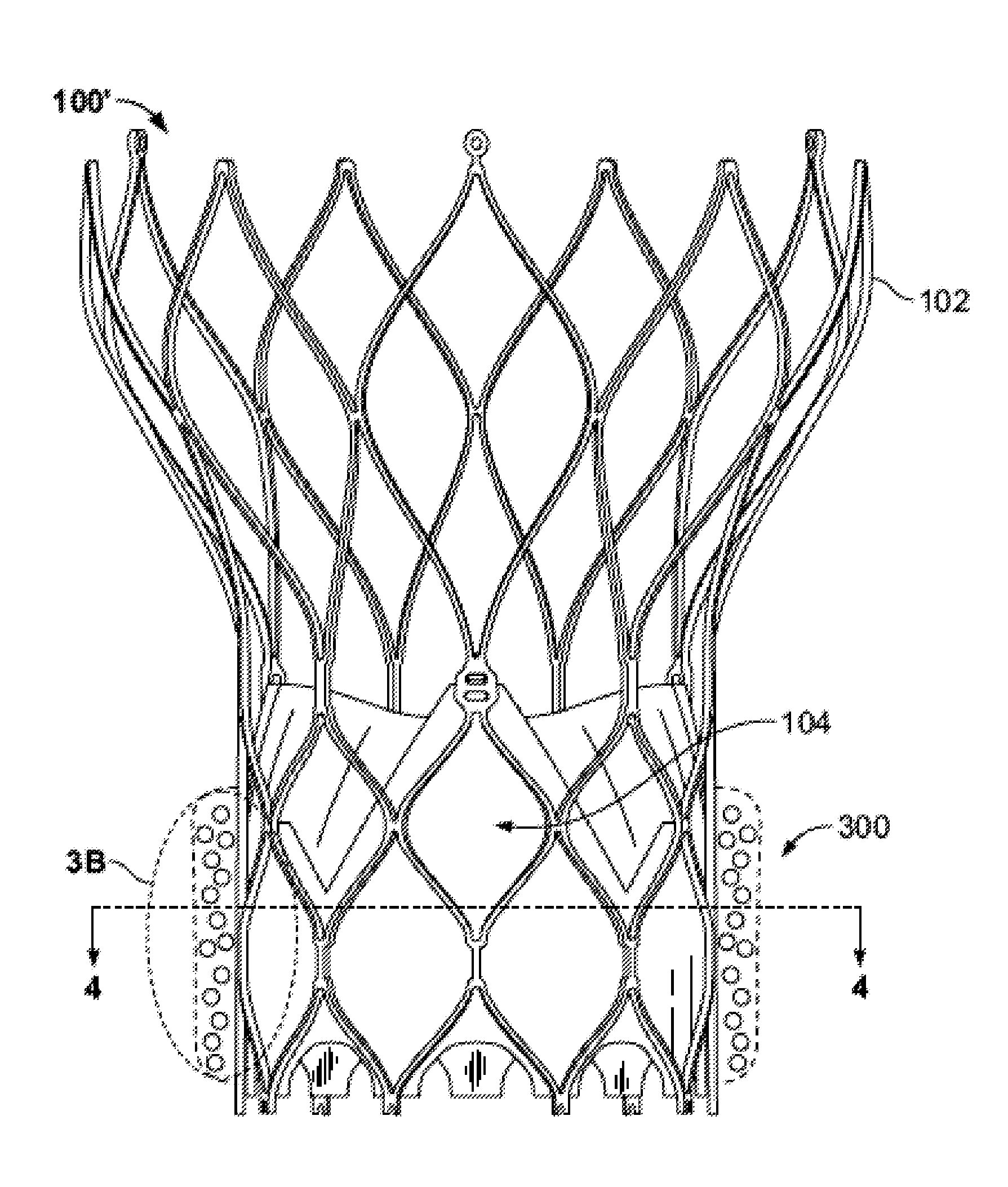 Prosthetic heart valve with expandable microspheres