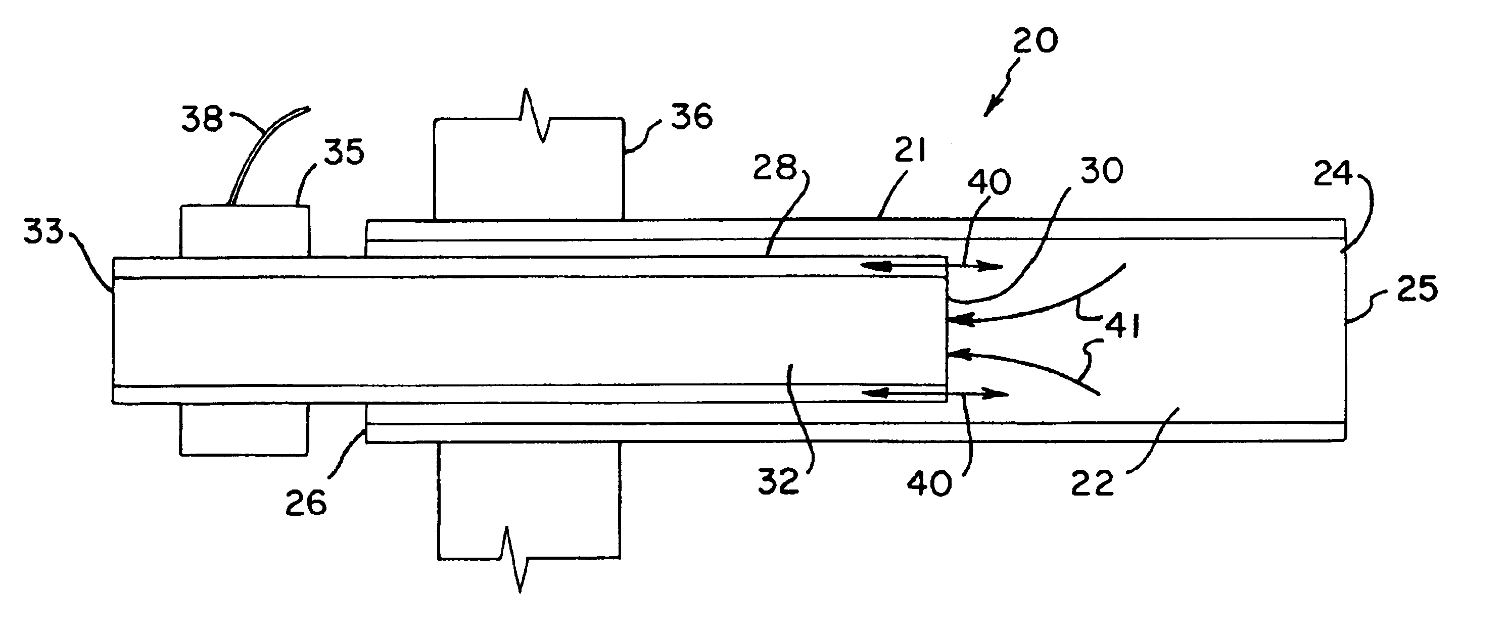 Ultrasonically actuated needle pump system