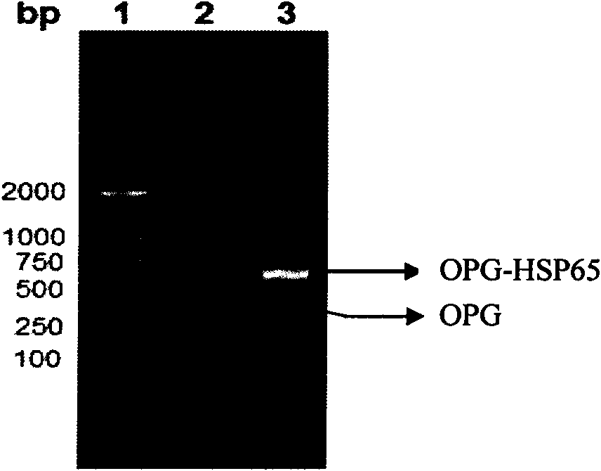 Preparation method and application of osteoporotegerin-heat-shock protein 65-fused protein