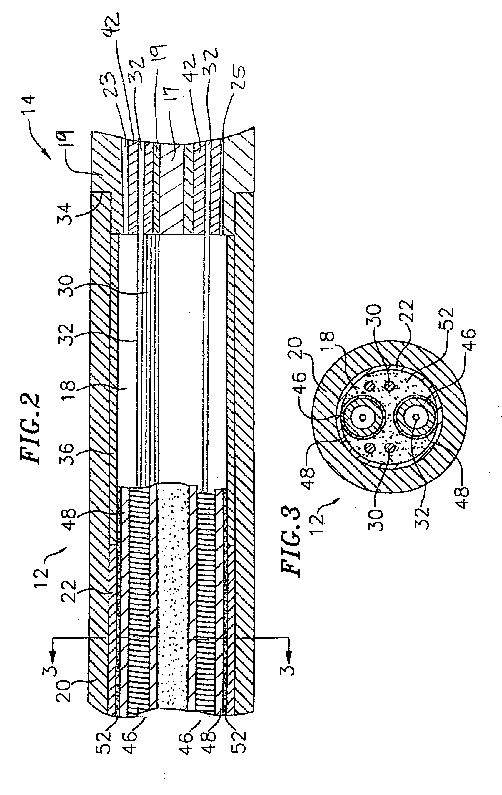 Steerable catheter with in-plane deflection