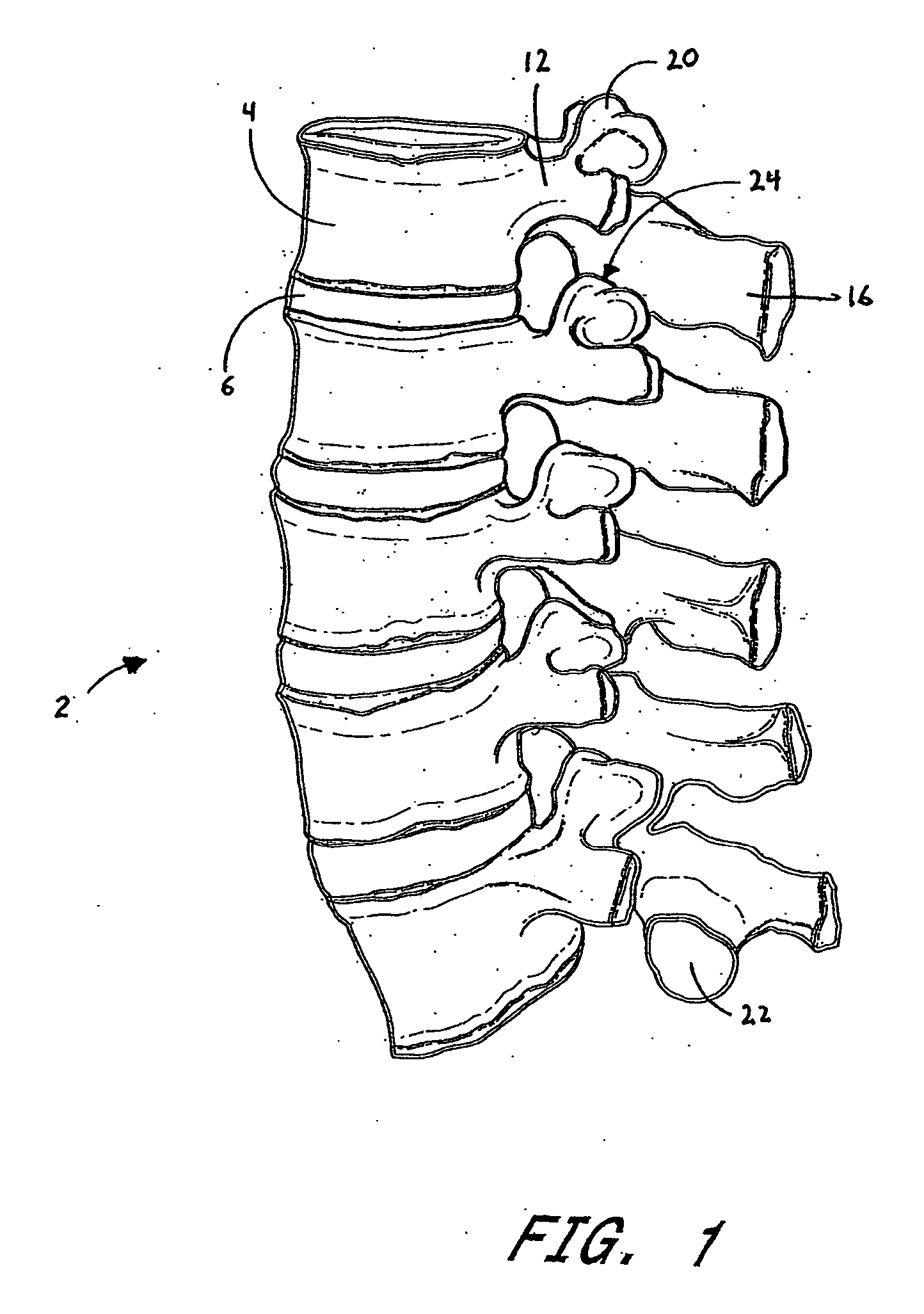 Flanged interbody fusion device with hinge