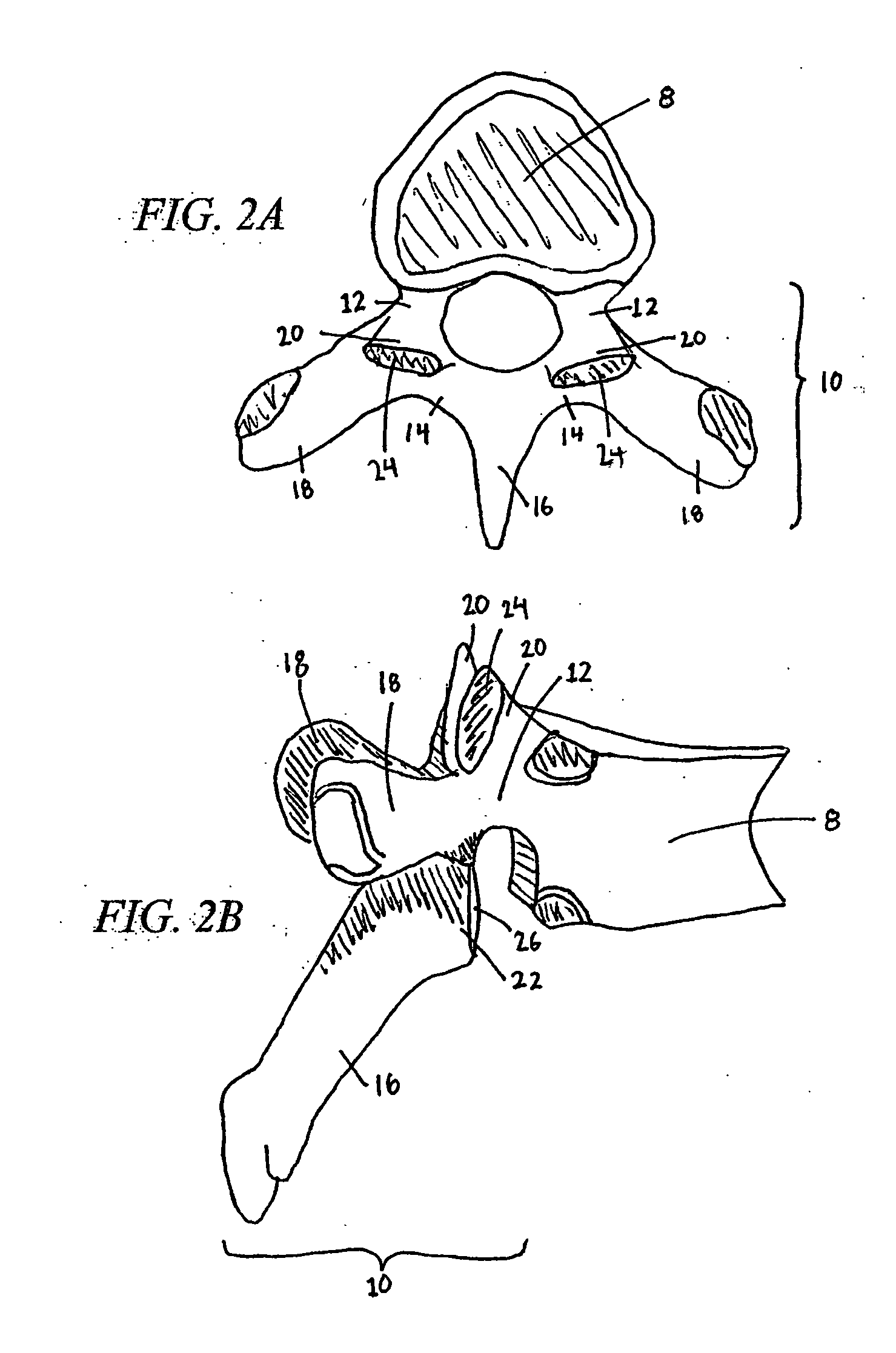 Flanged interbody fusion device with hinge