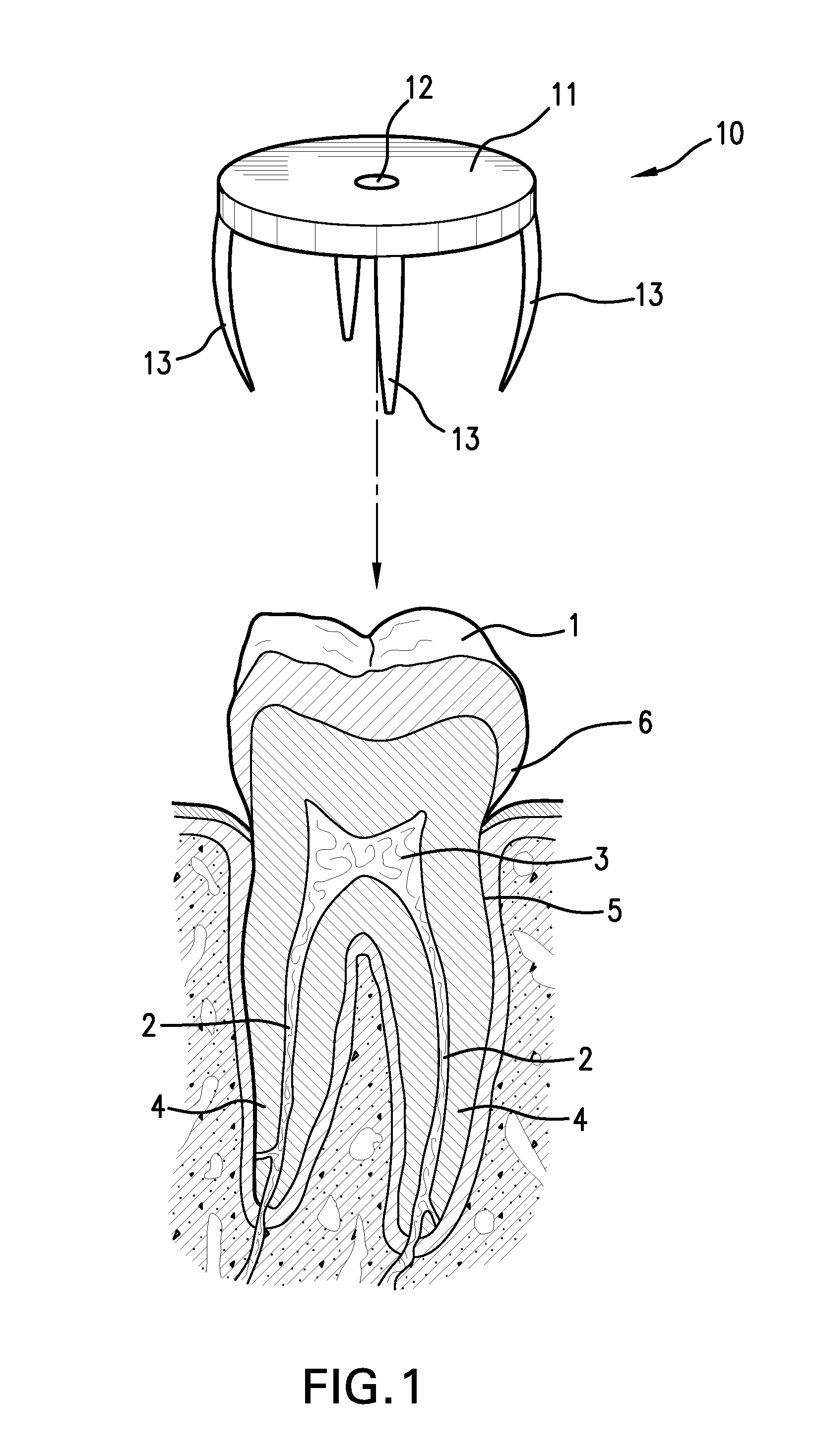 Device and method for locating a pulp chamber in a tooth