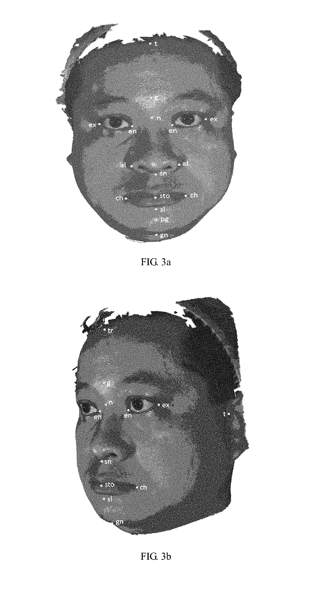 Recognition of human faces based on population verified reproducible measurements between facial anthropological landmarks on 2 dimensional or 3 dimensional human photographs