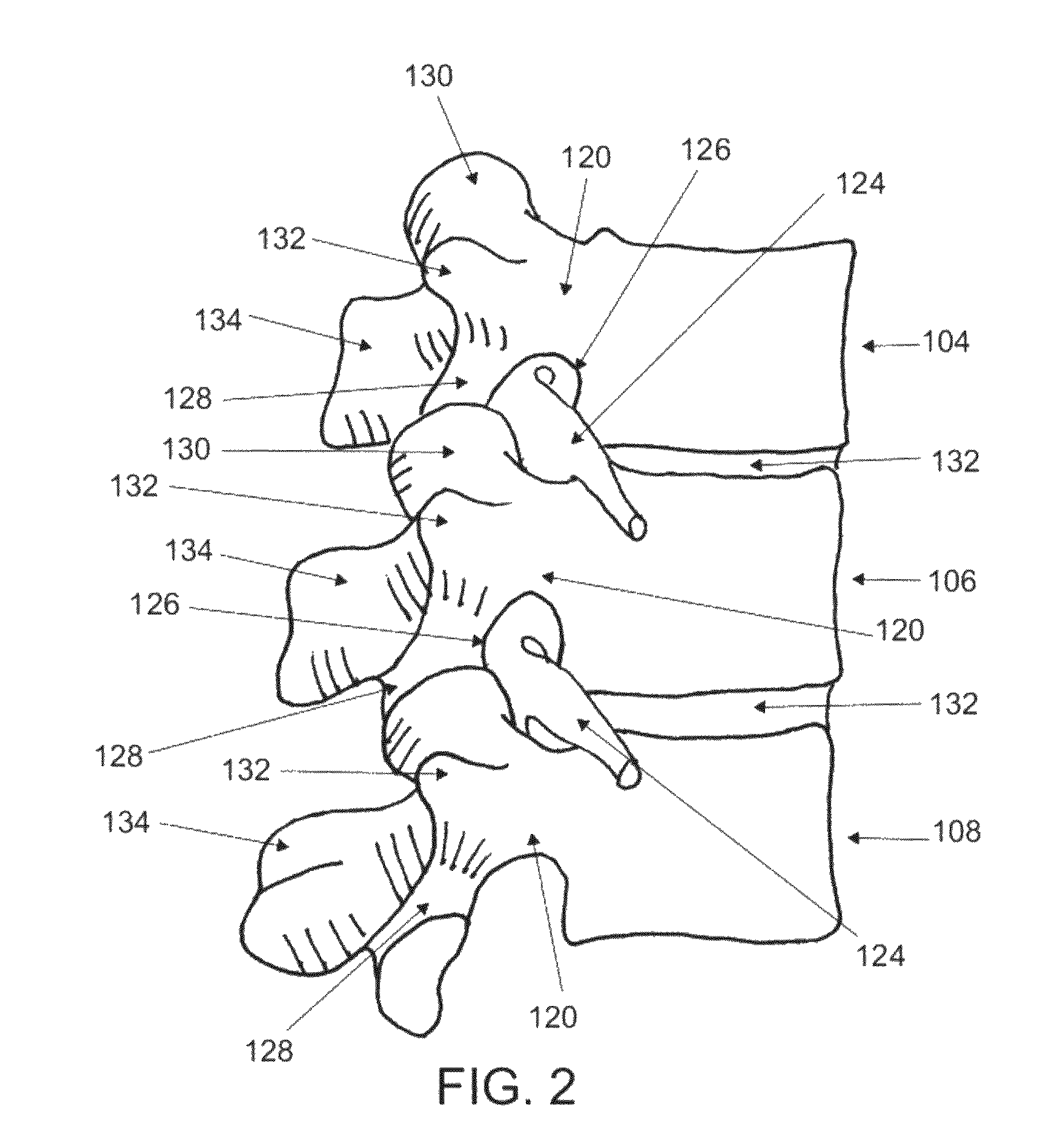 Systems and methods for cable-based tissue removal