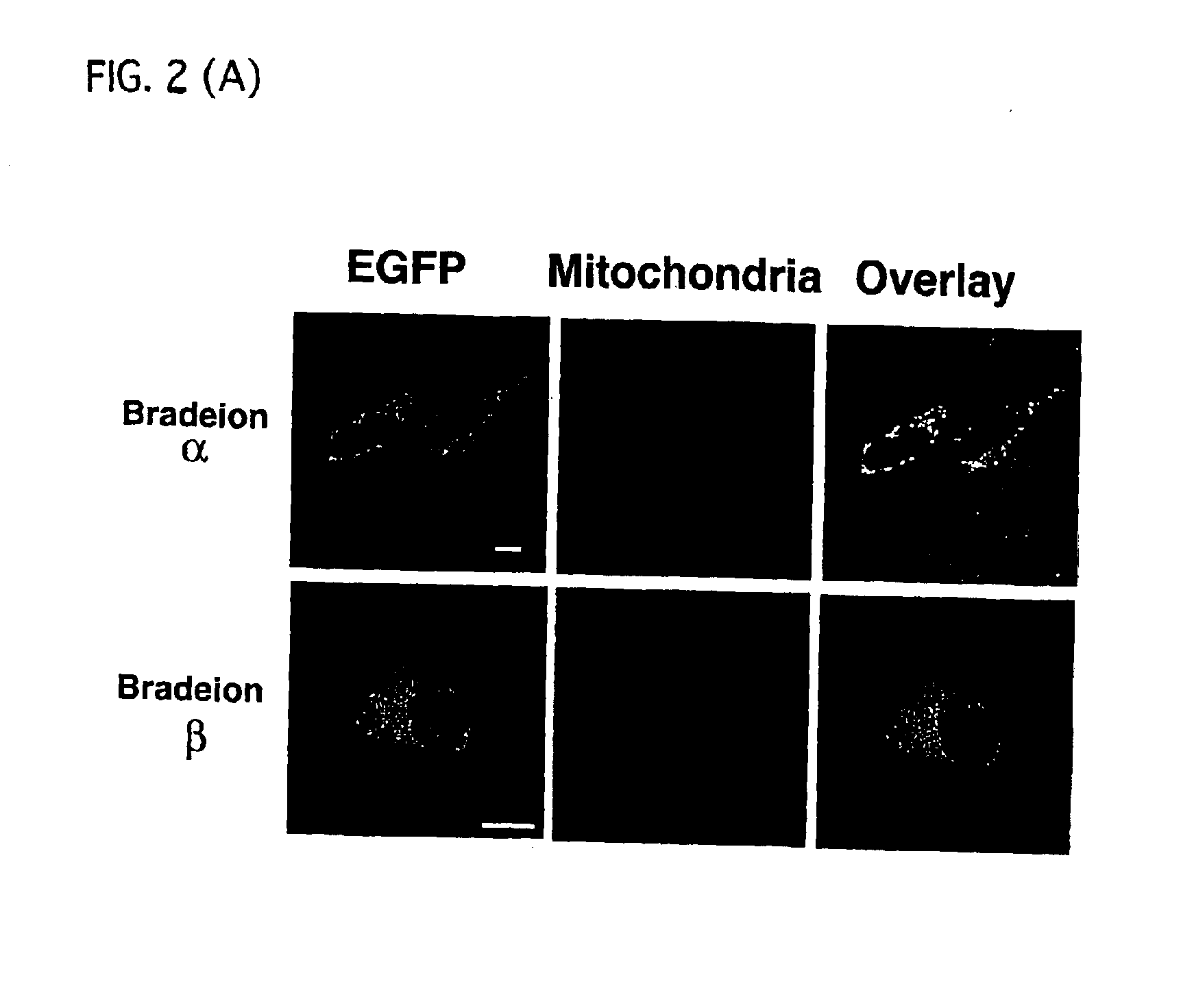 Human derived bradeion proteins, DNA coding for the proteins, and uses thereof