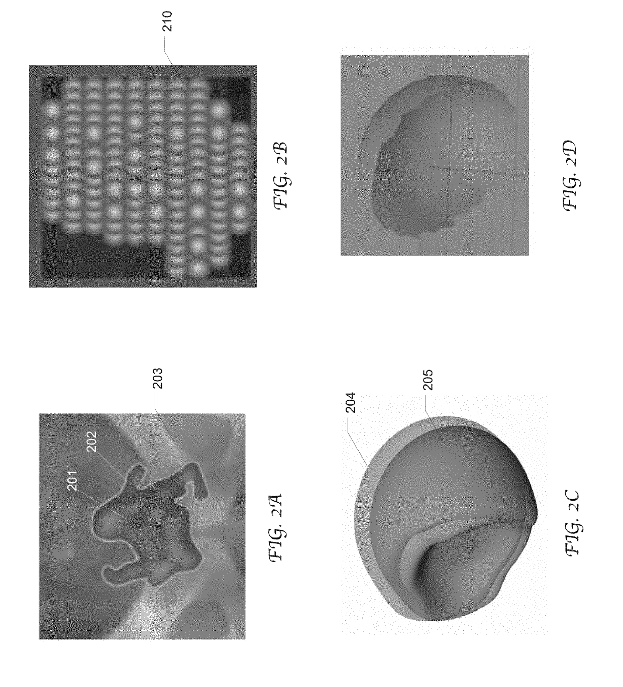 Dynamic beam's eye view of proton therapy irradiation shown in anatomical context