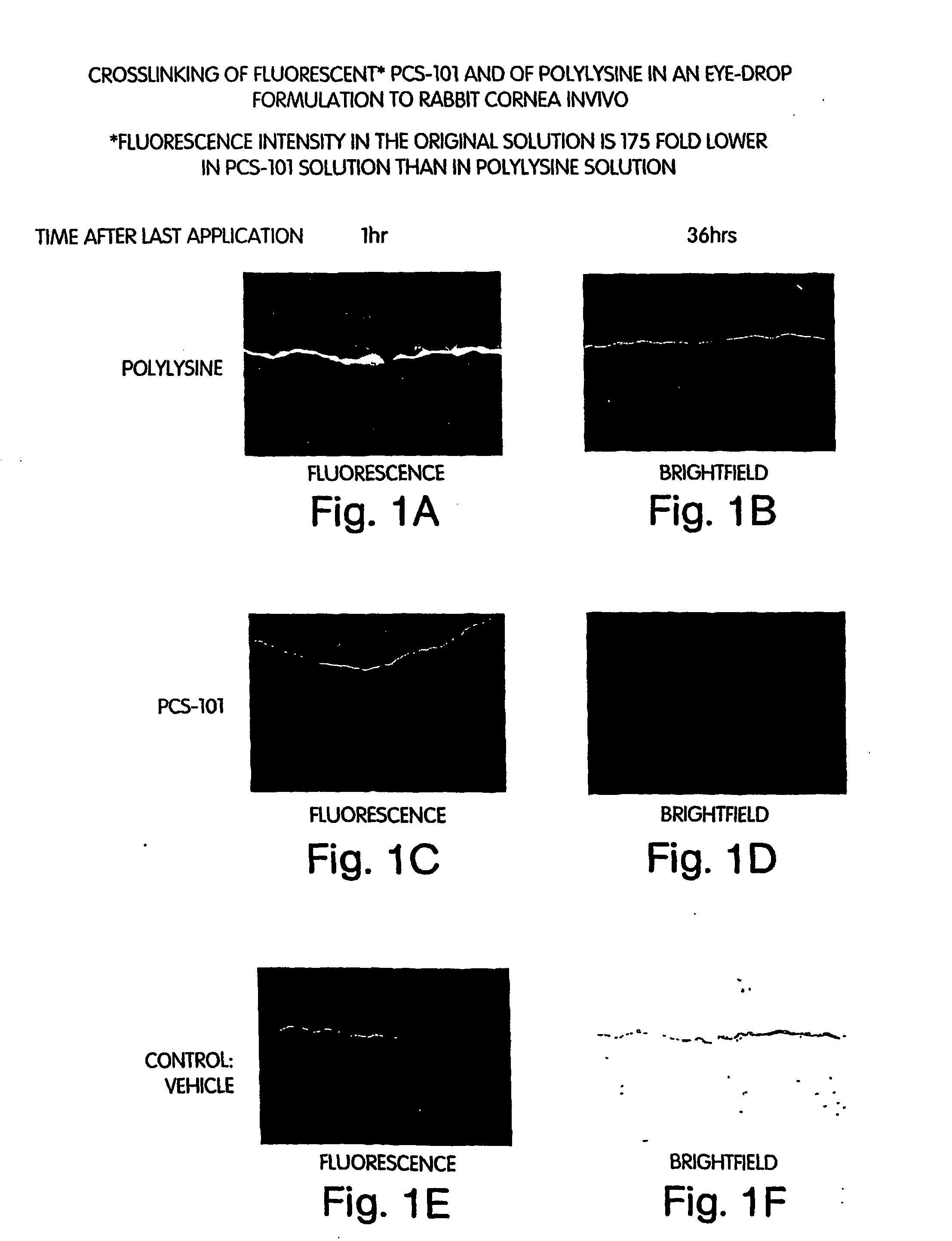 Compositions of hyaluronic acid and methods of use