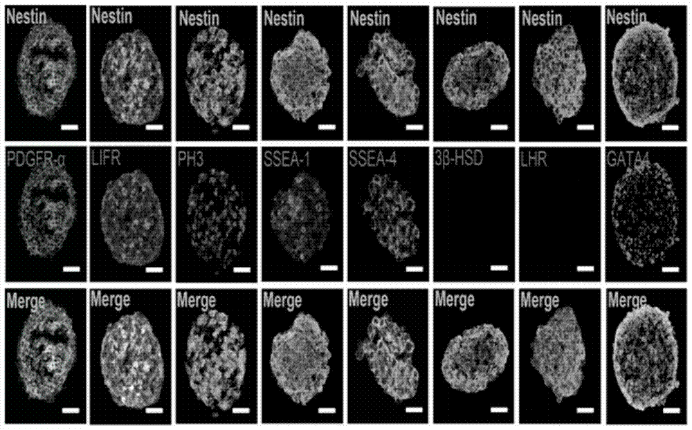 A method for isolating, culturing and using testicular mesenchymal stem cells expressing nestin