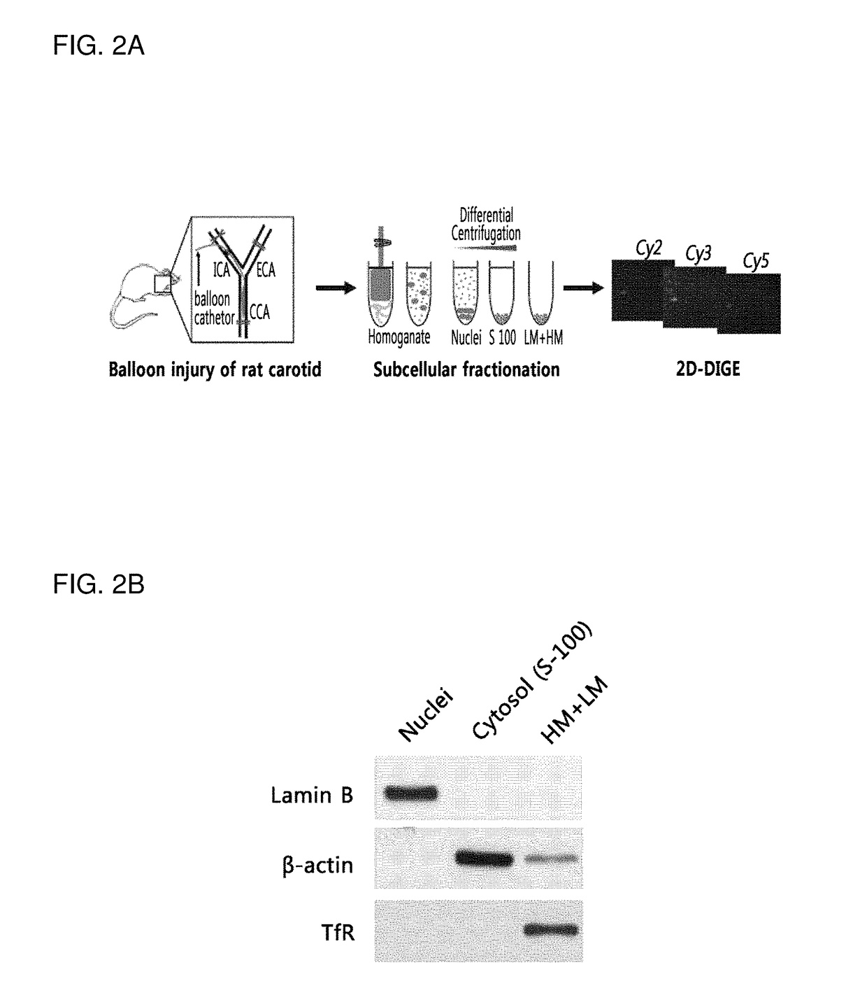 Biomarker for diagnosing vascular diseases and the uses thereof