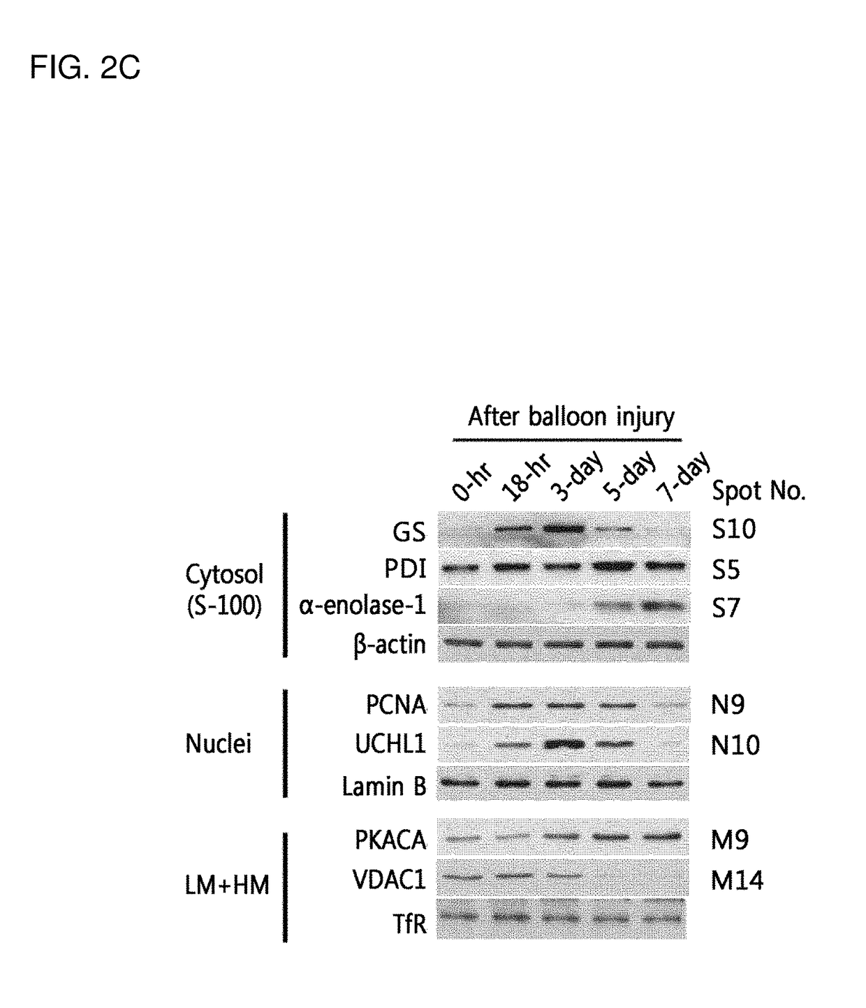 Biomarker for diagnosing vascular diseases and the uses thereof