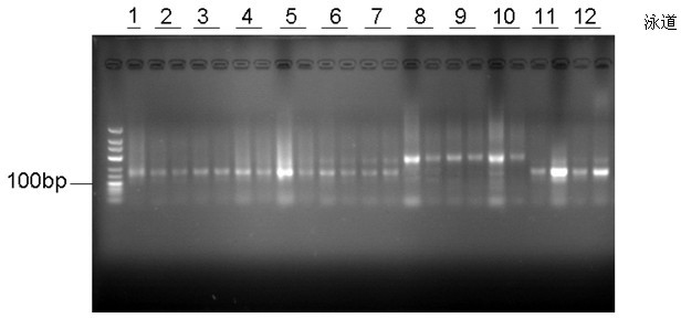 Mycobacterium tuberculosis surface lipolysaccharide-antistatic nucleic acid aptamer and application thereof