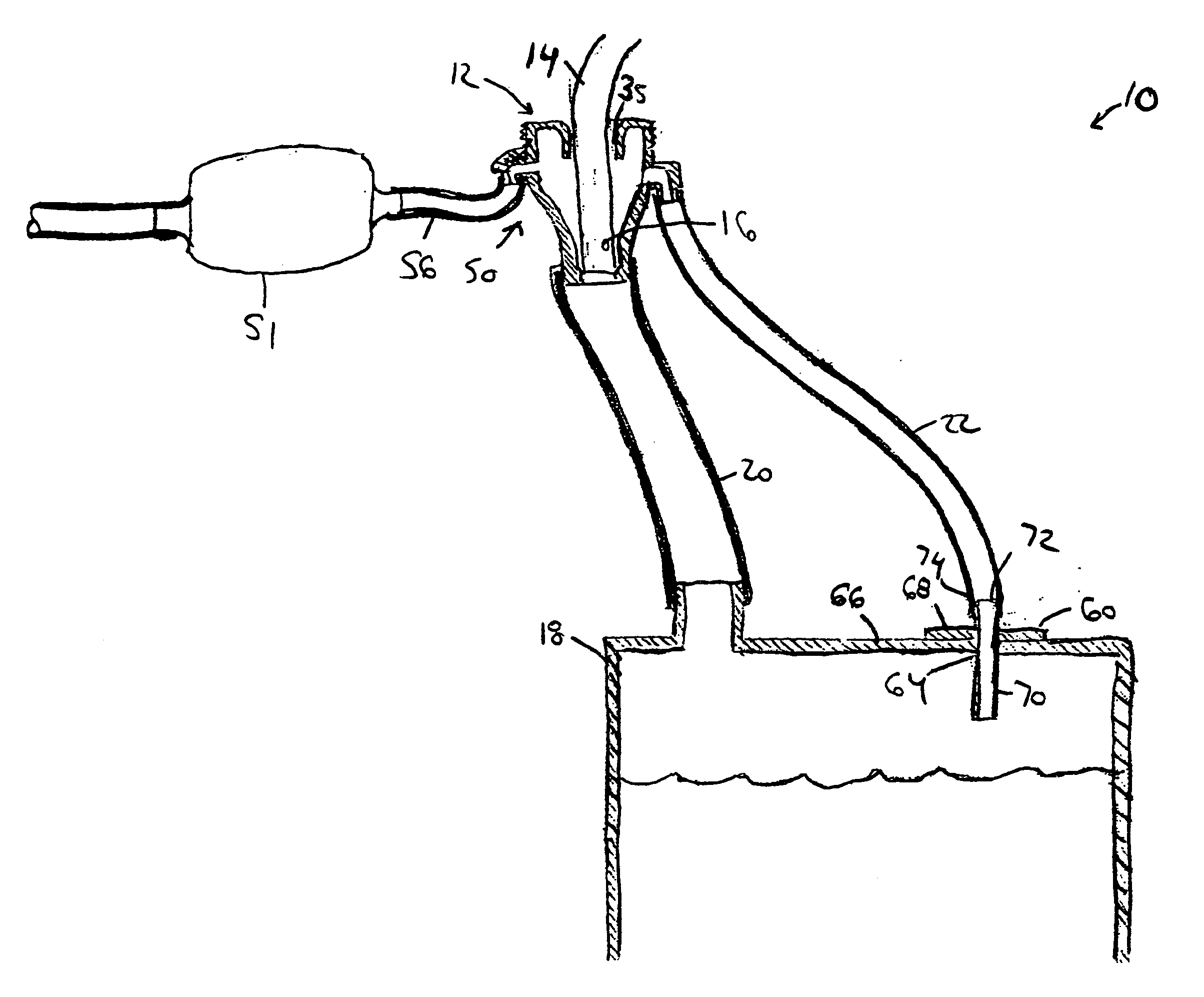 Fuel overflow prevention device