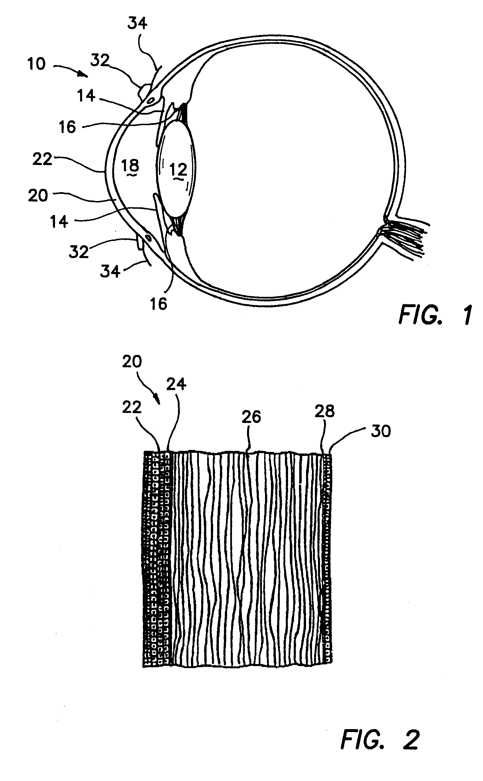 Corneal onlays and methods of producing same