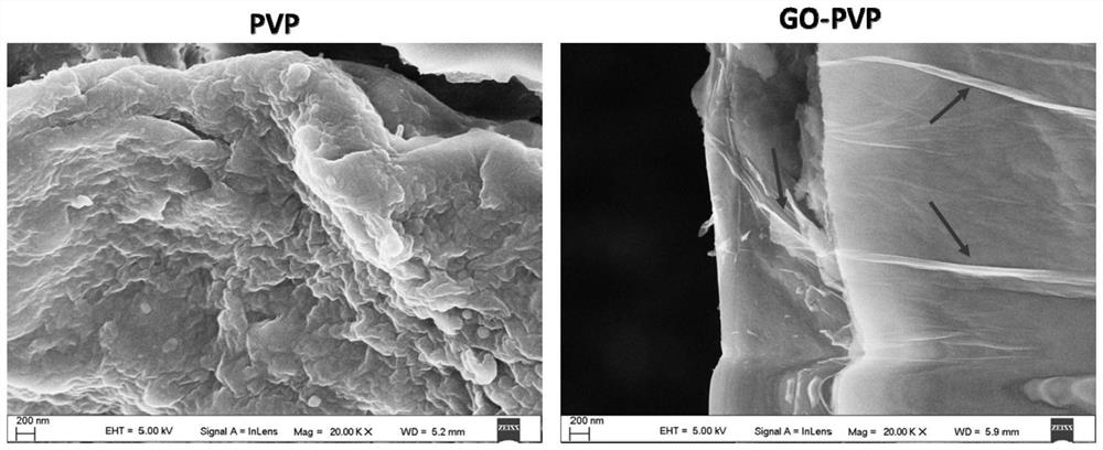 A graphene transdermal drug delivery microneedle