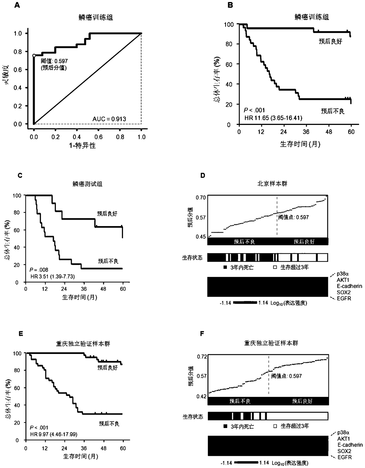 A system for predicting the prognosis of lung squamous cell carcinoma patients