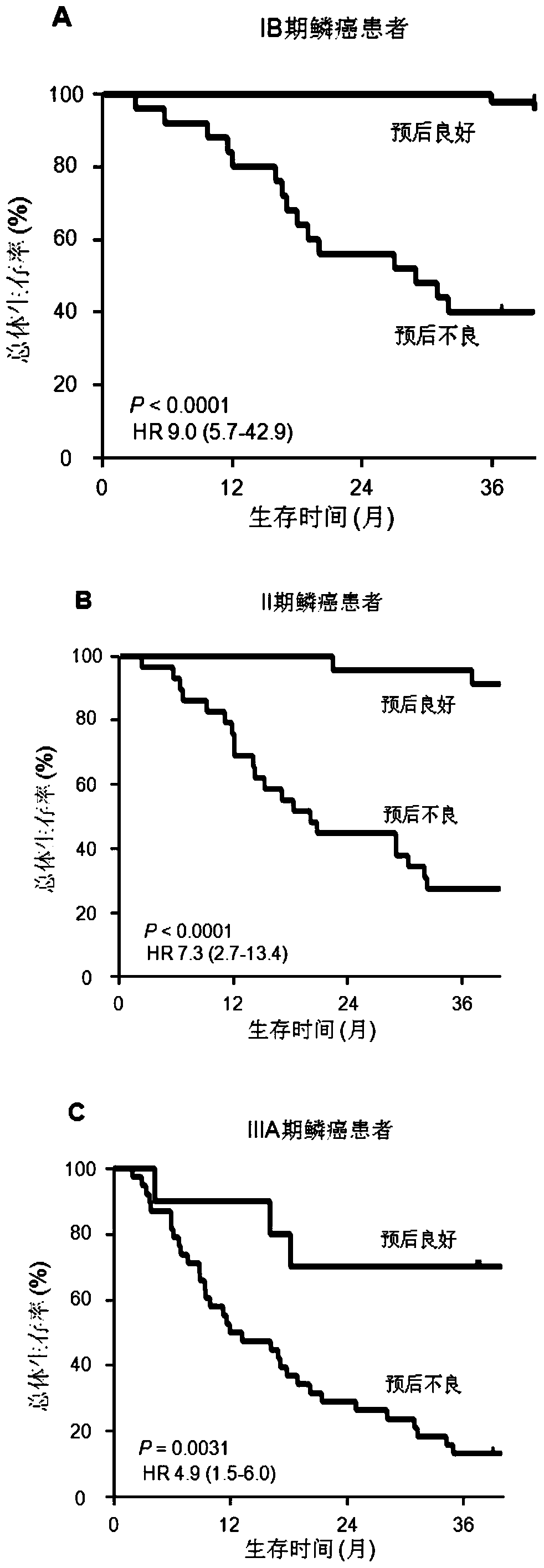 A system for predicting the prognosis of lung squamous cell carcinoma patients