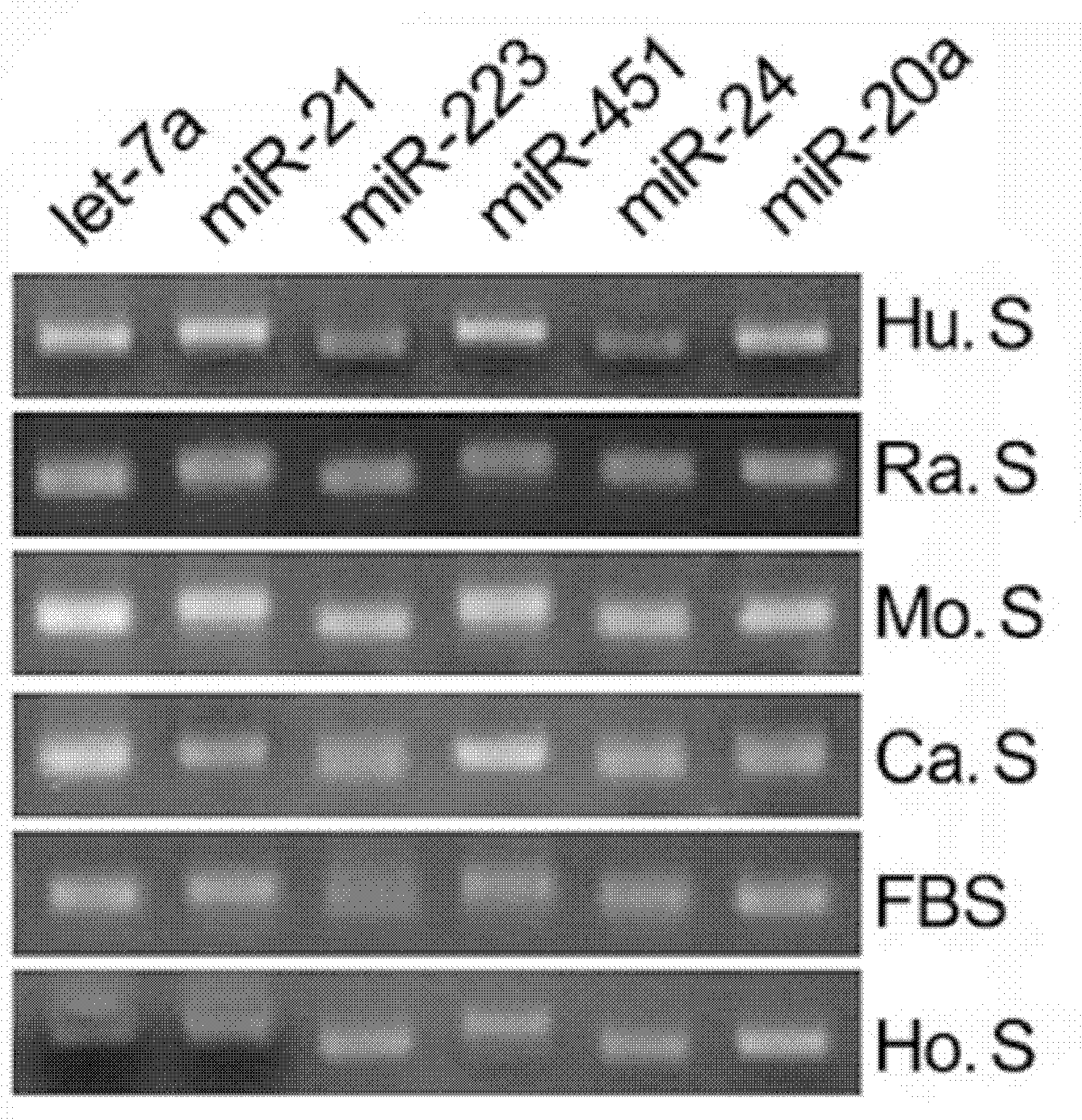 Cervical cancer detection markers and detection method, kit and biochip thereof