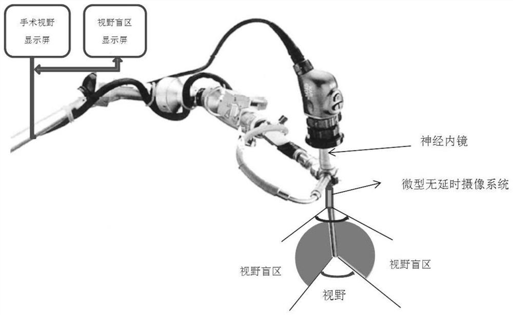 Neuroendoscope device