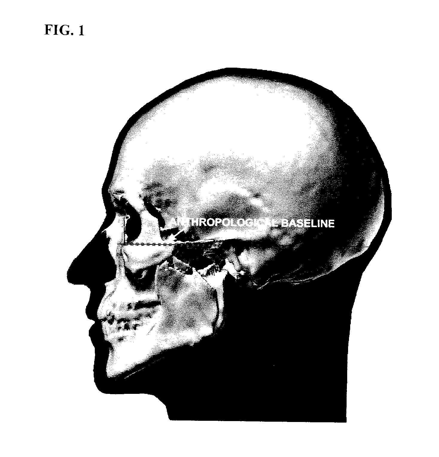 Method and apparatus for unambiguously determining orientation of a human head in 3D geometric modeling