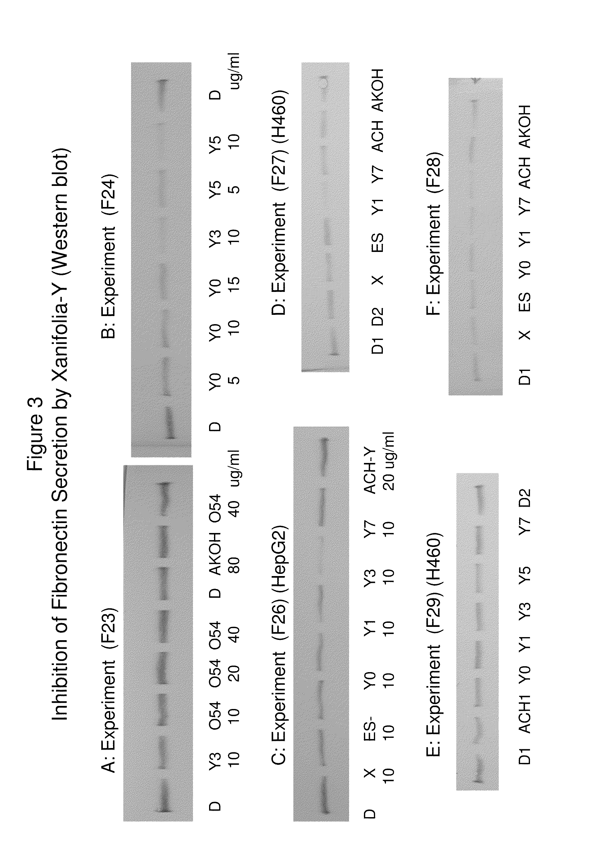 Blocking the migration or metastasis of cancer cells by affecting adhesion proteins and the uses of new compounds thereof