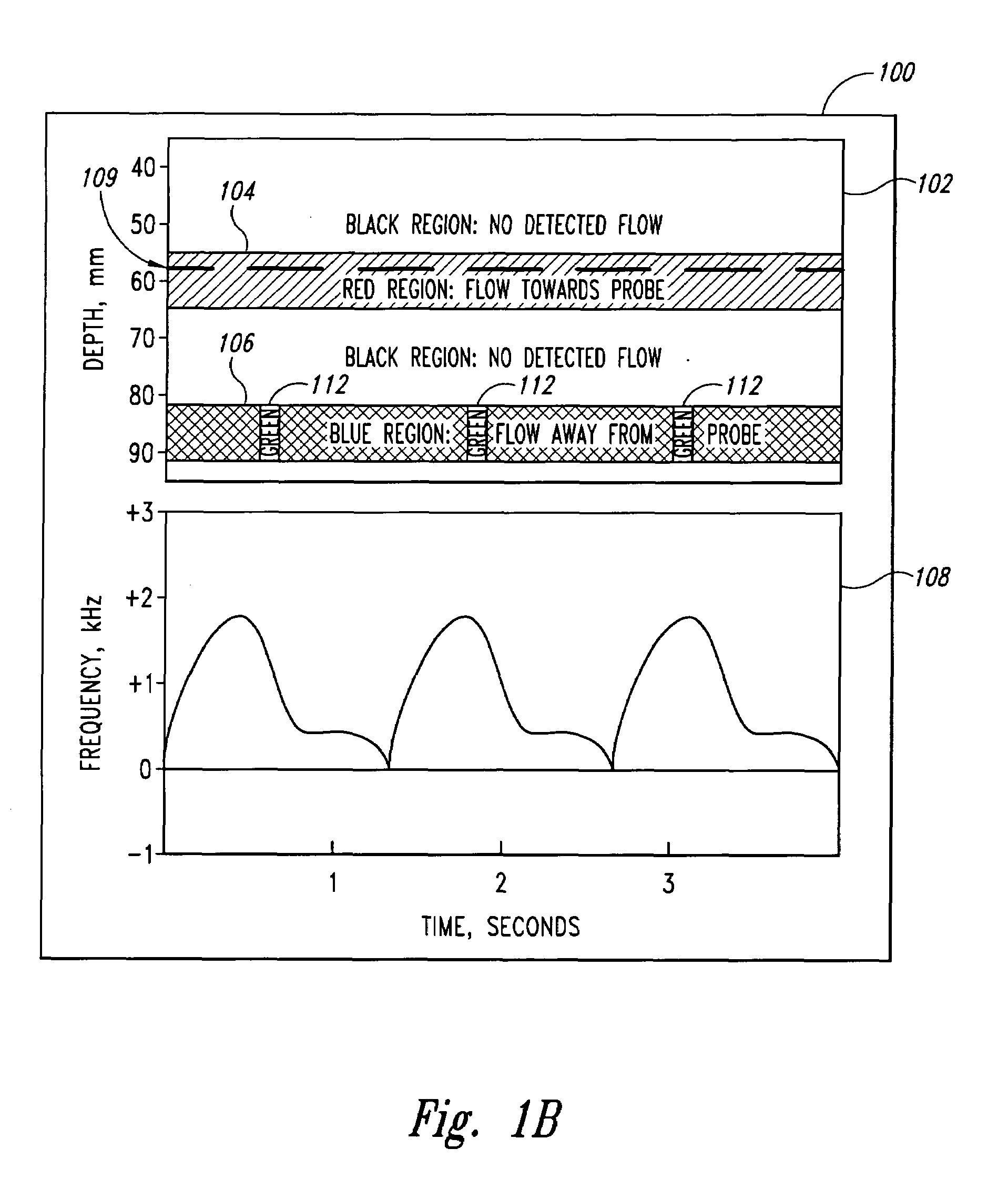 Doppler ultrasound method and apparatus for monitoring blood flow and hemodynamics