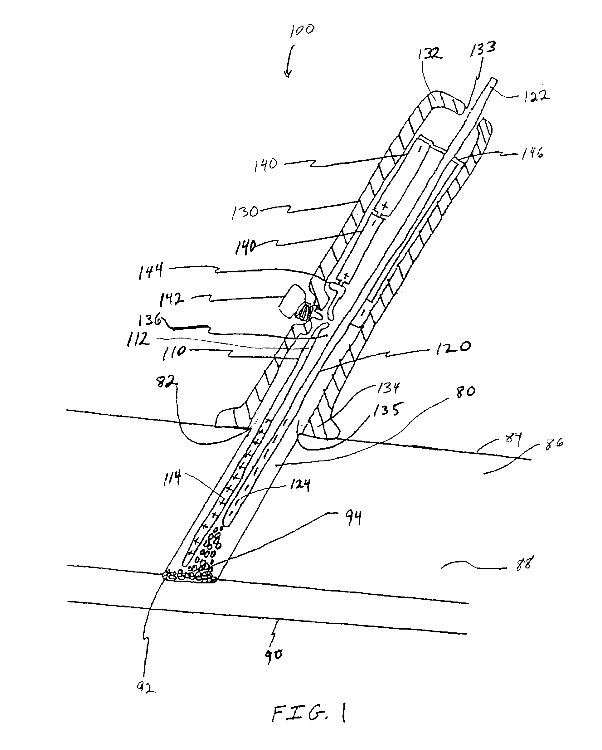 Apparatus and method for electrically induced thrombosis