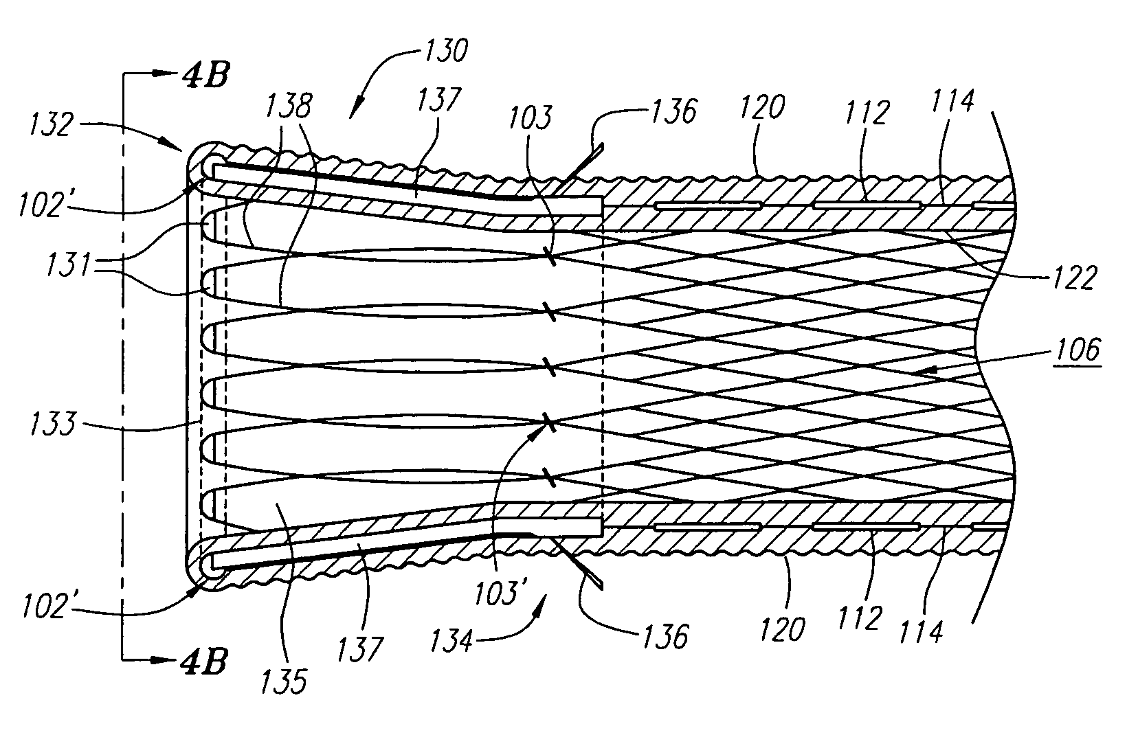 Methods for forming and fabricating textured and drug eluting coronary artery stent