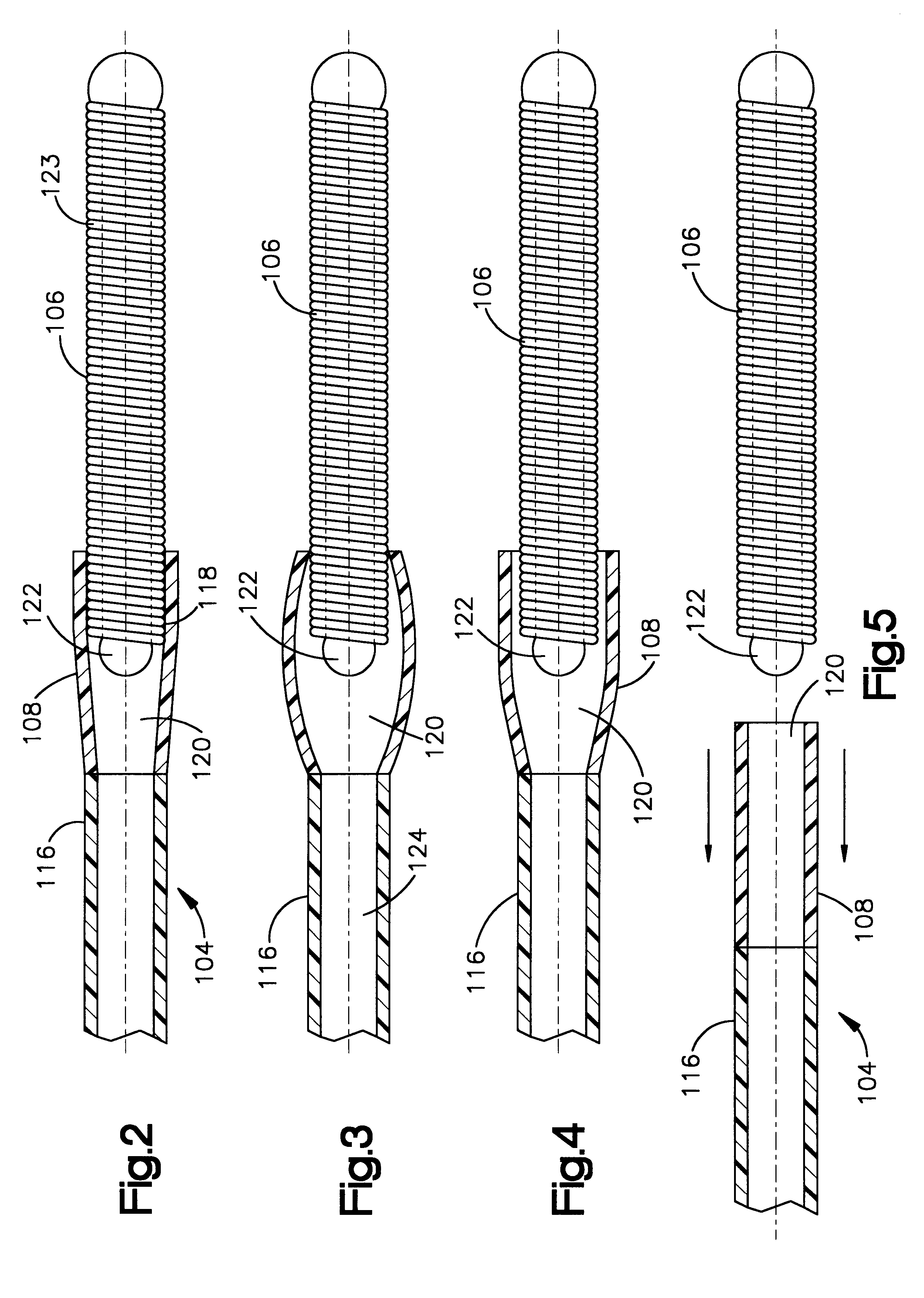 Embolic coil deployment system with improved embolic coil